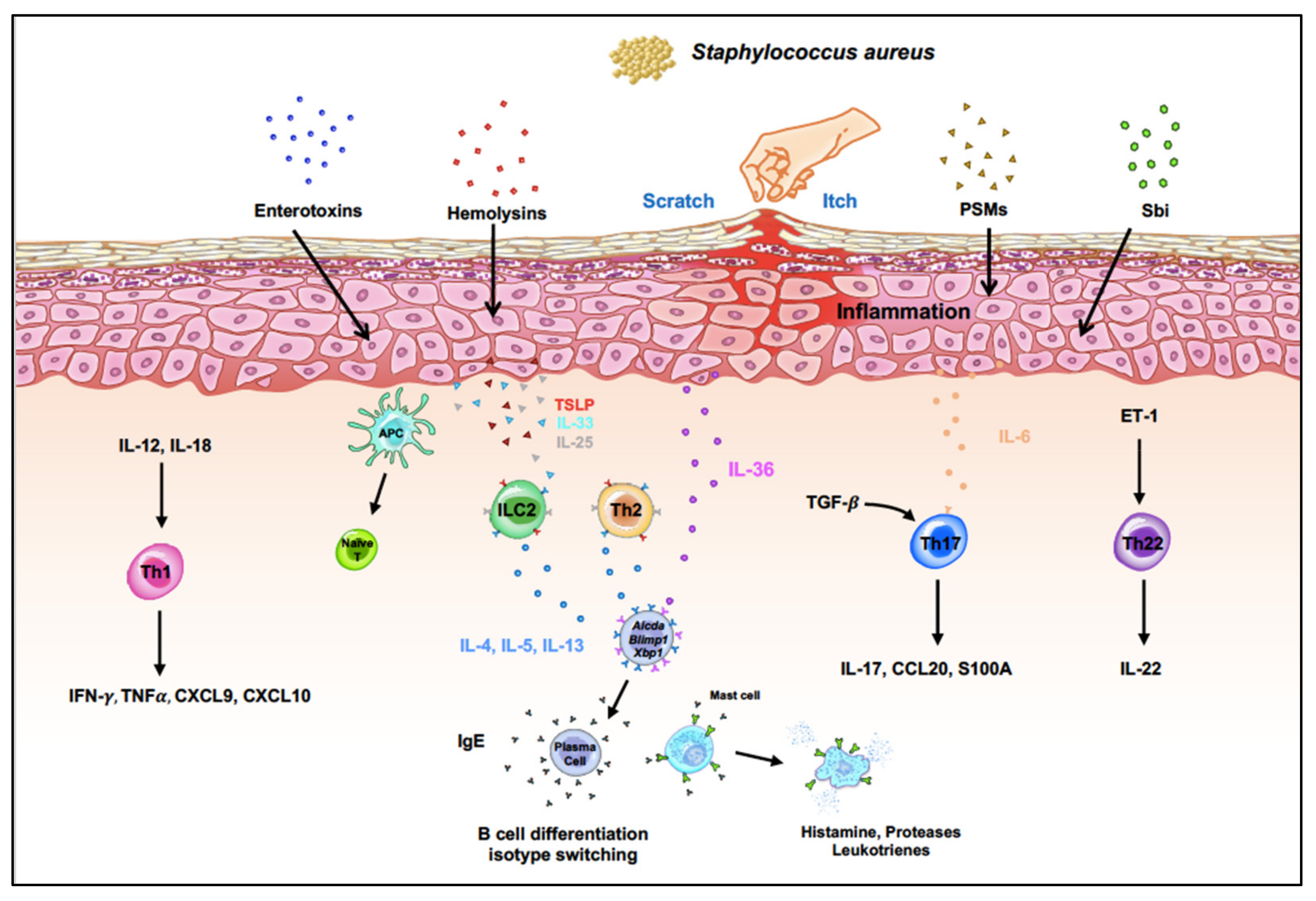 Doctor explains Staphylococcus aureus fatalities and link to eczema