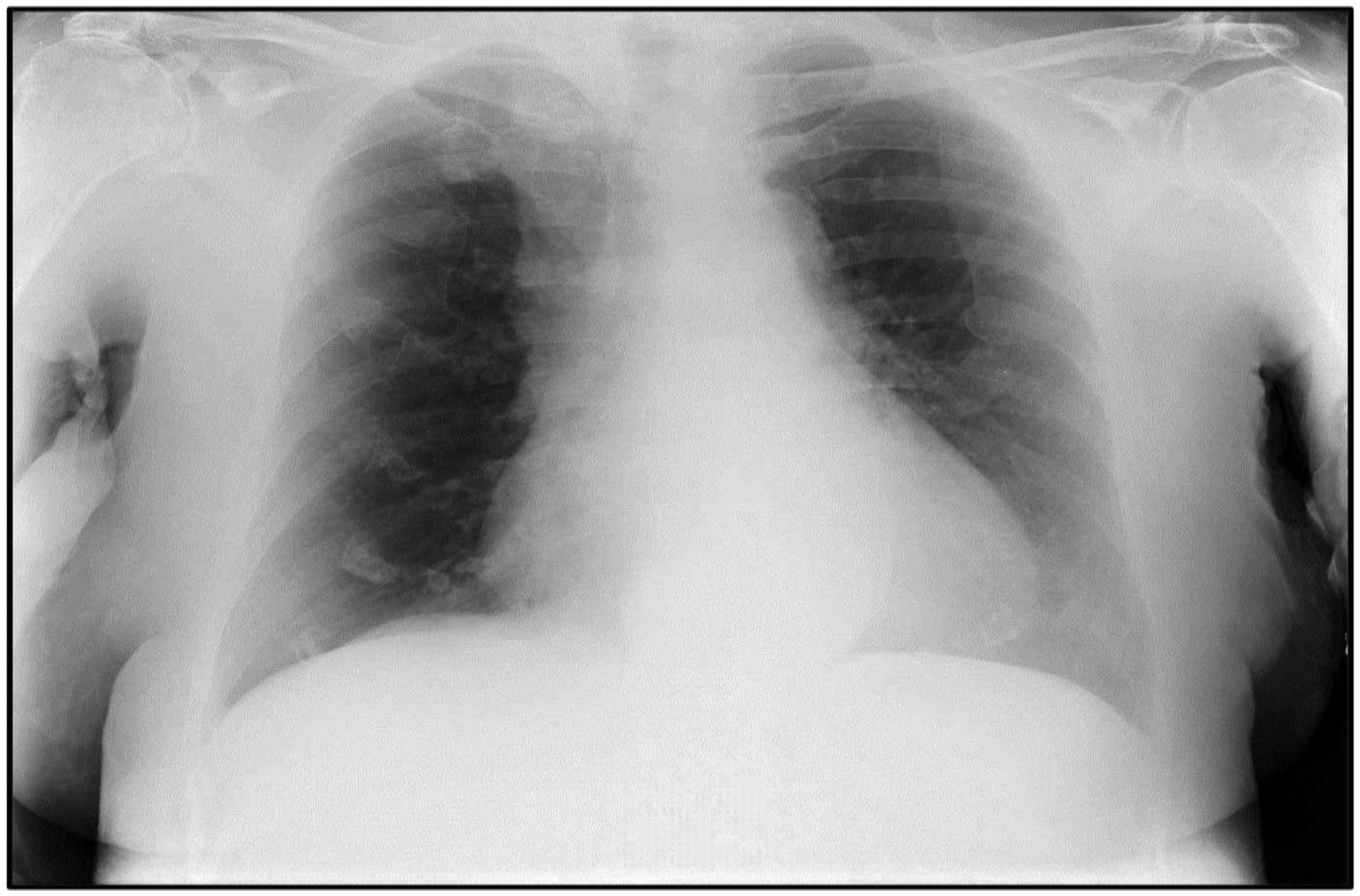 Pathogens 11 00435 g001 550