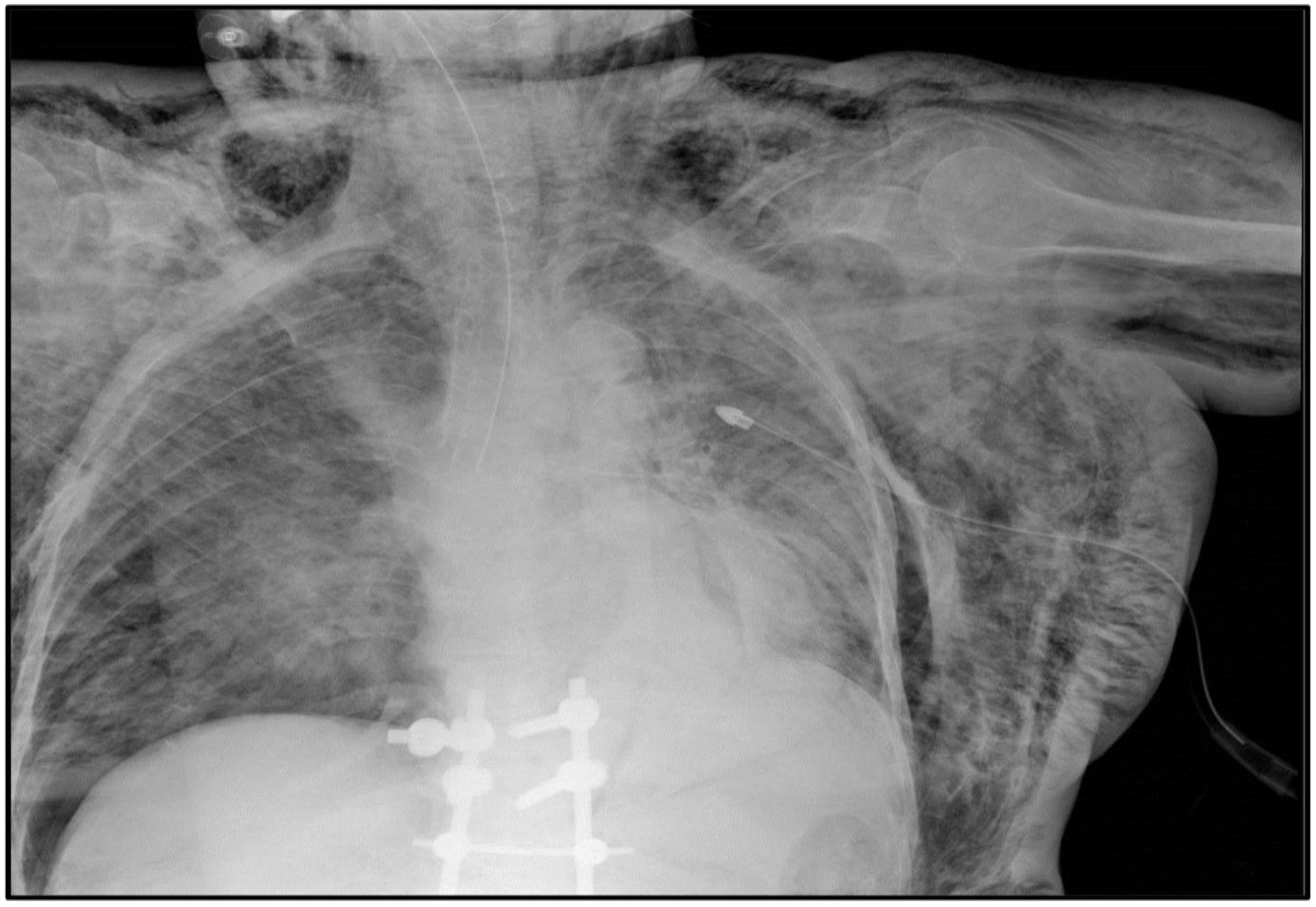 Pathogens 11 00435 g003 550