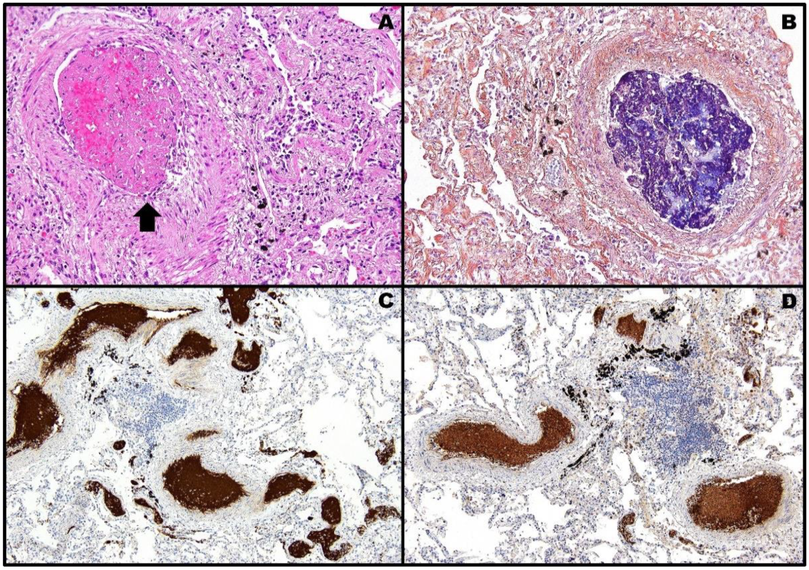 Pathogens 11 00435 g004 550