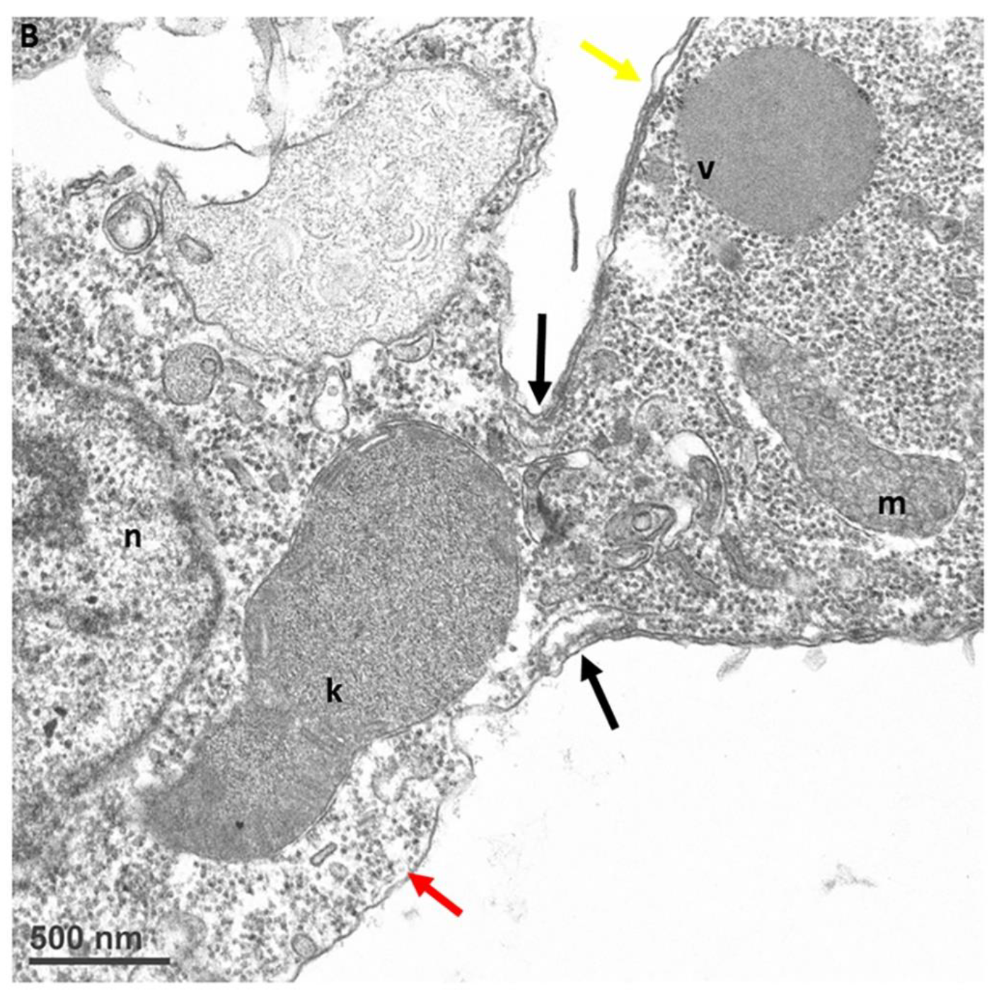 Pathogens 11 00455 g009b