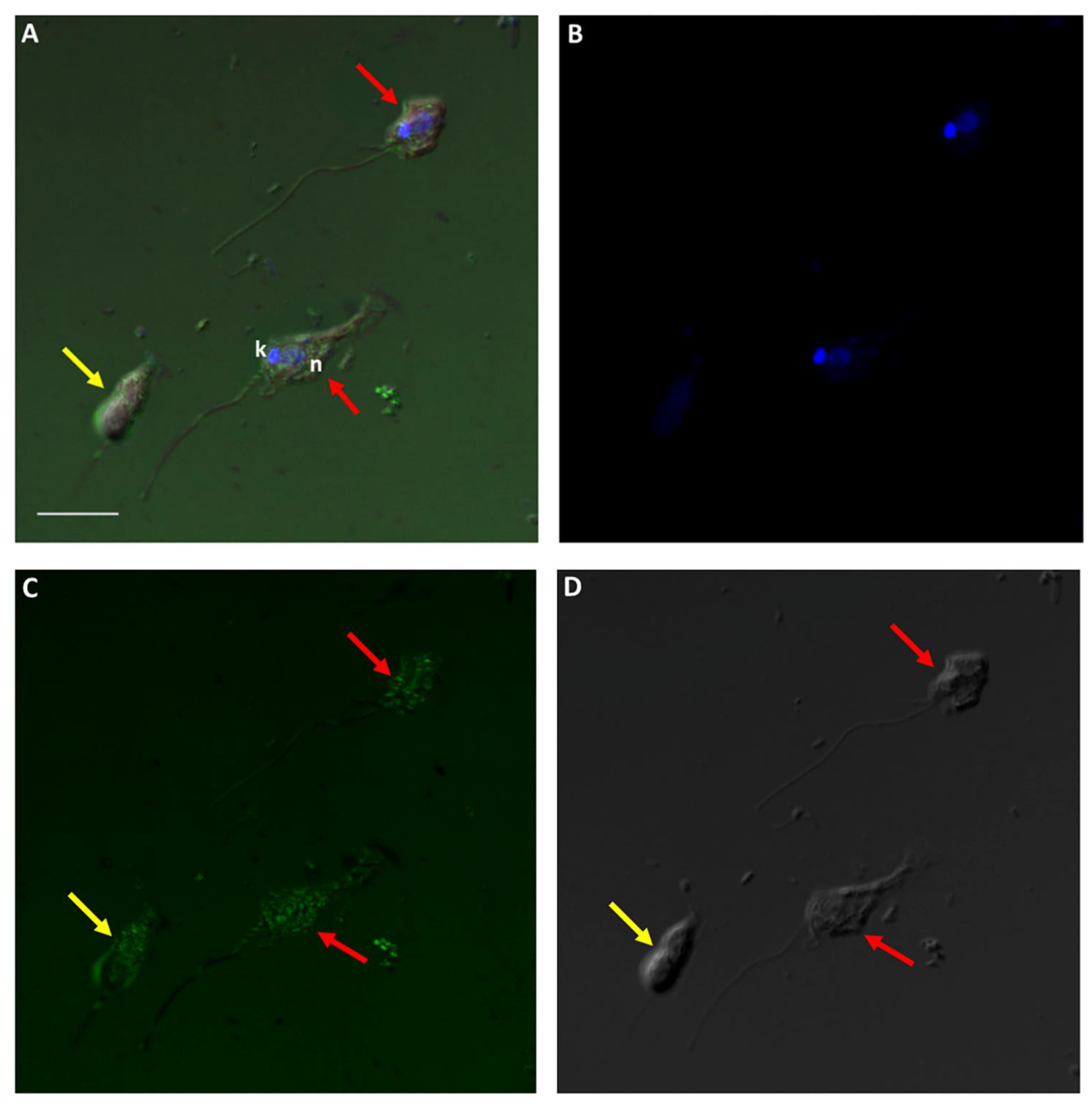 Pathogens 11 00455 g013