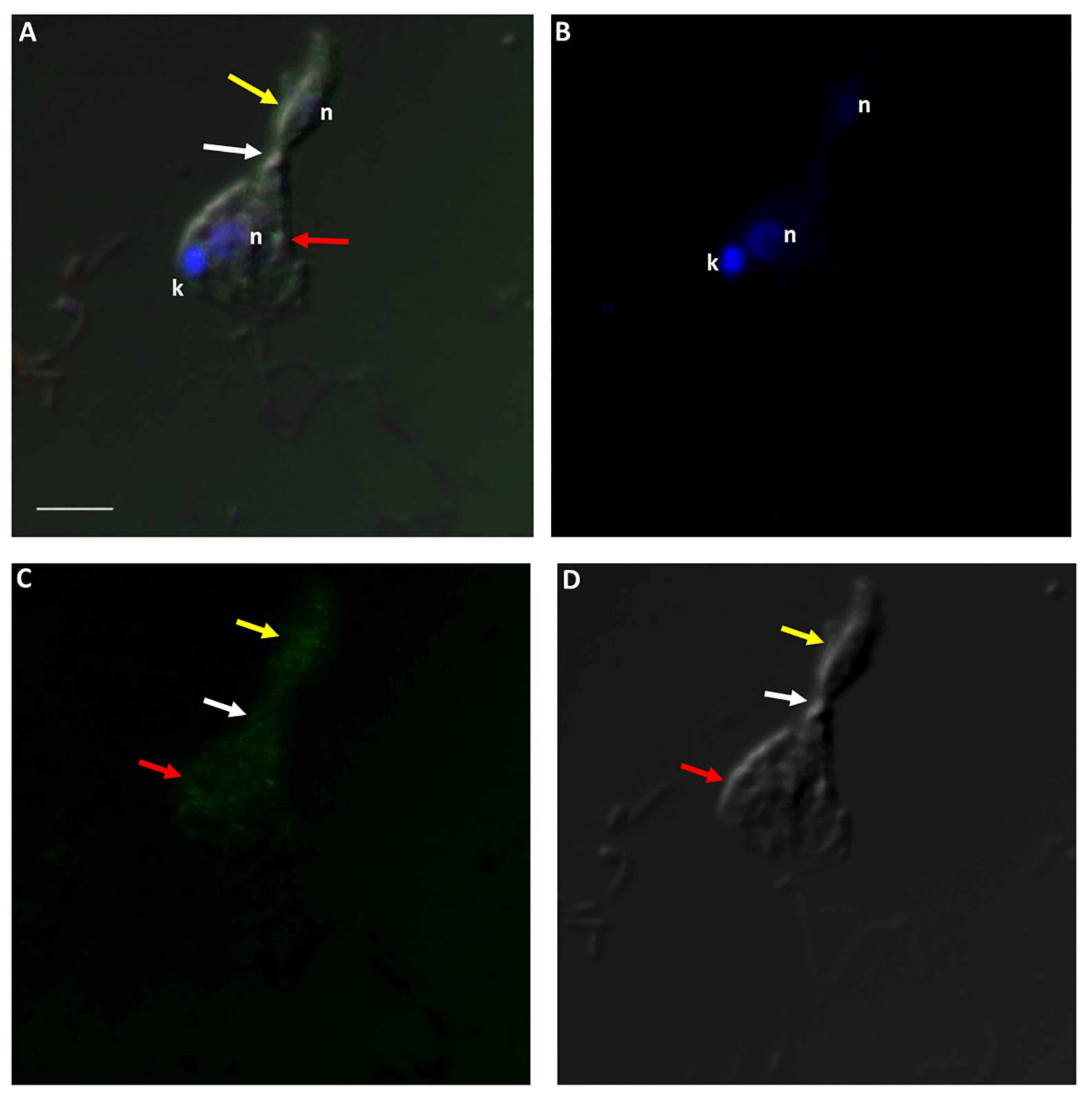 Pathogens 11 00455 g014