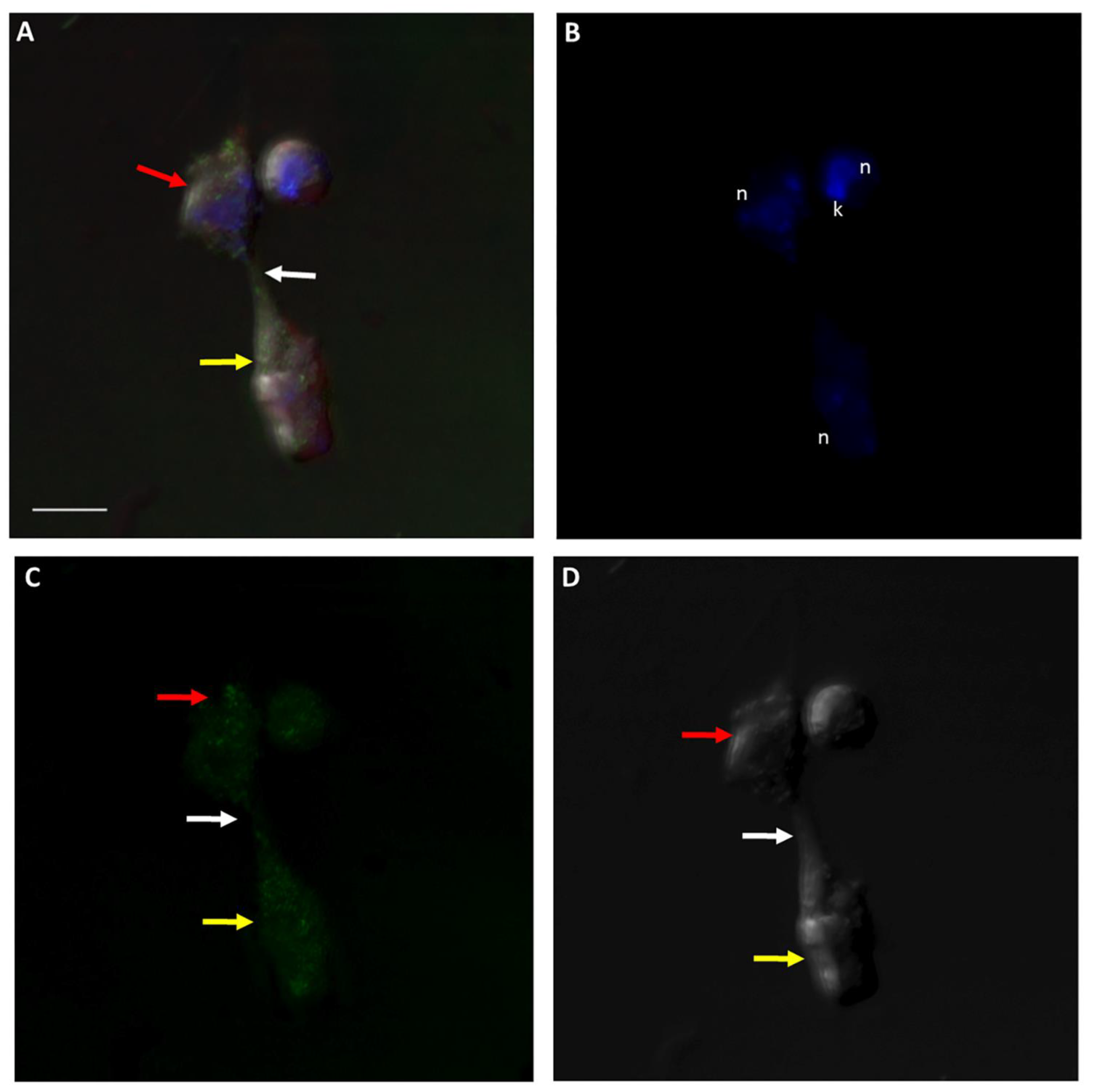Pathogens 11 00455 g015