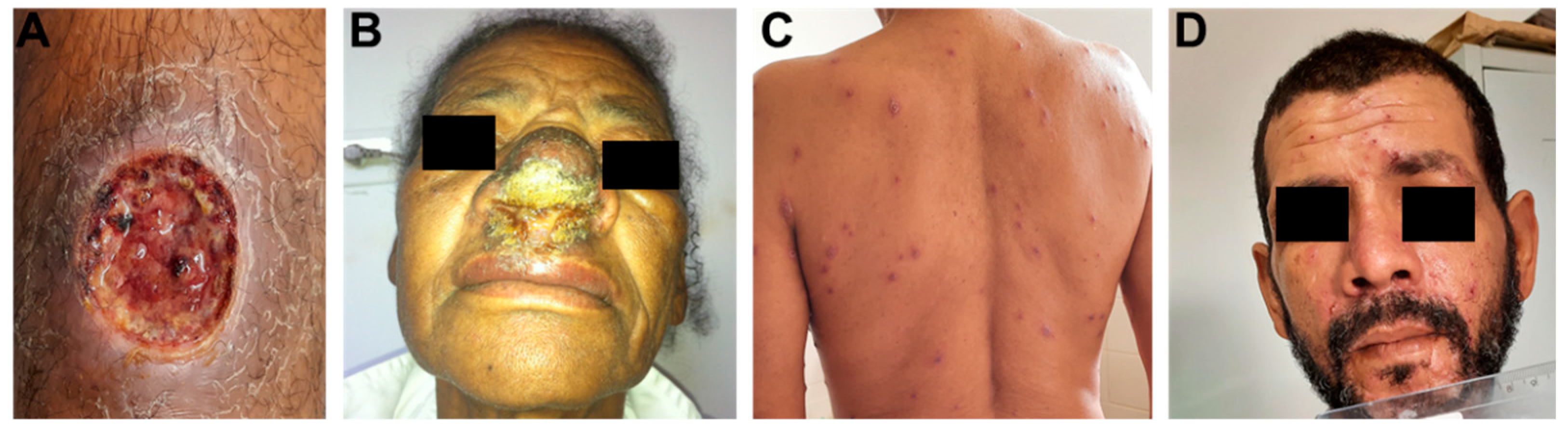 Pathogens 11 00466 g001