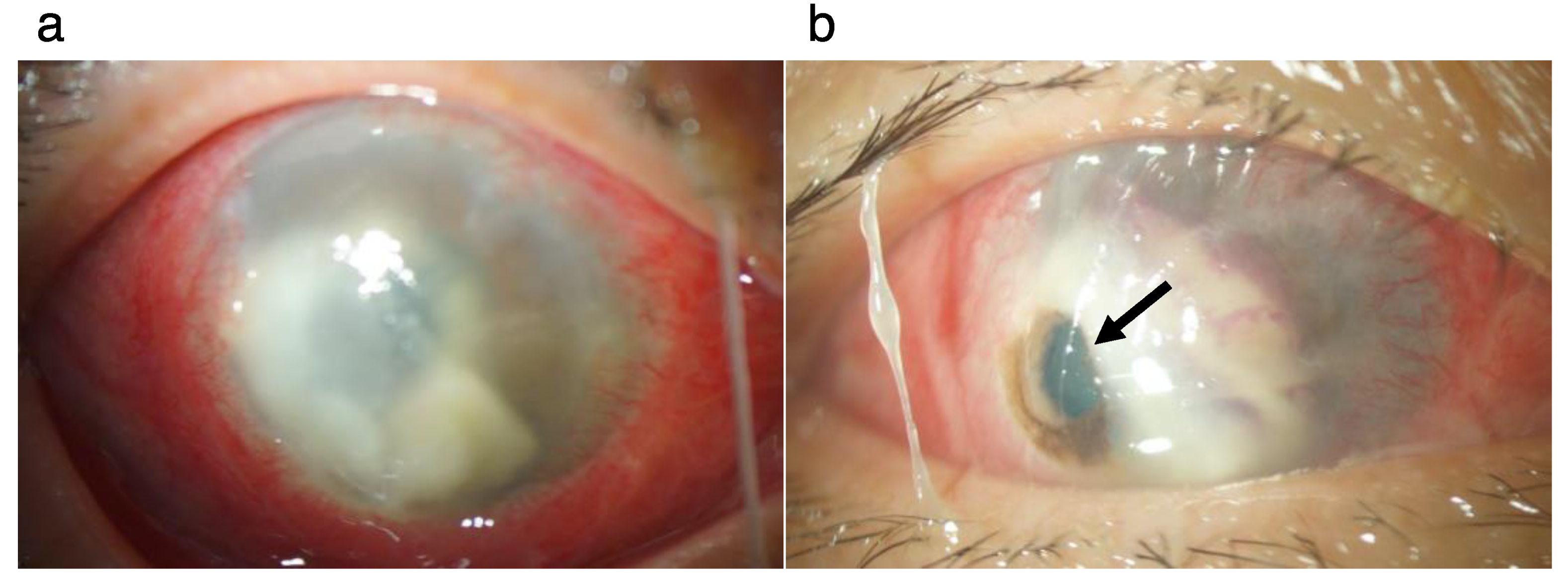 Pathogens 11 00526 g003