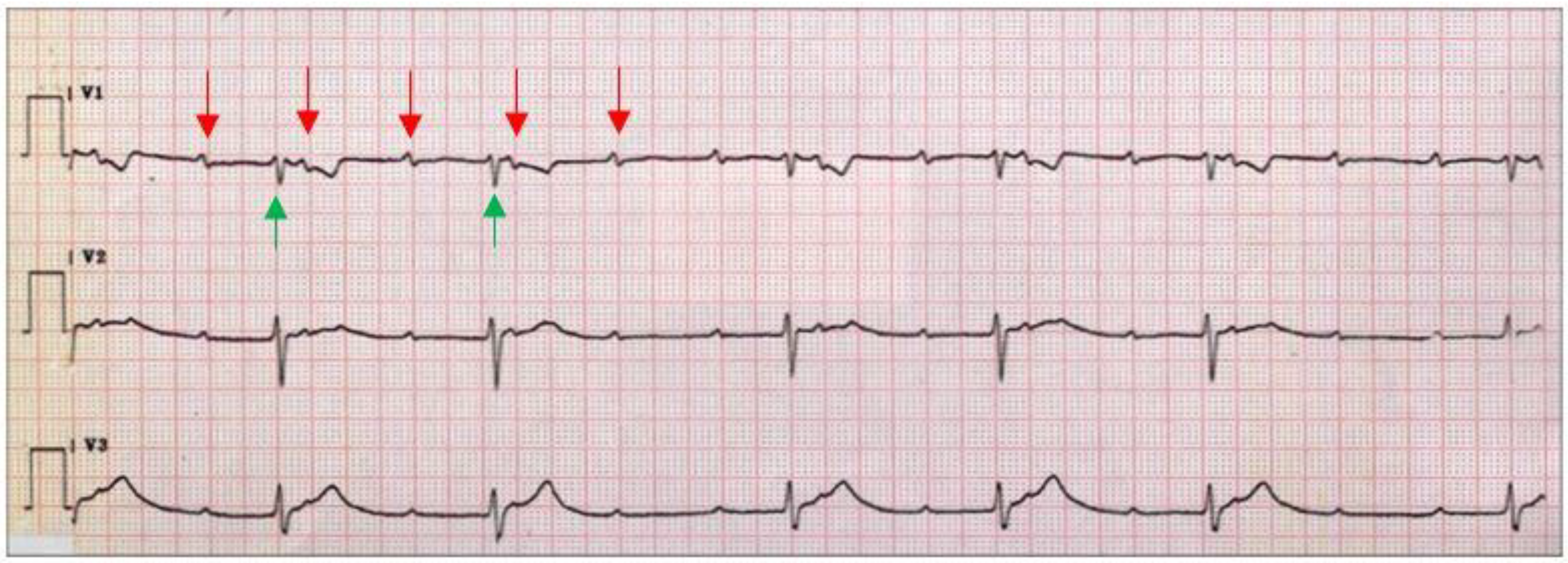 Pathogens 11 00582 g001