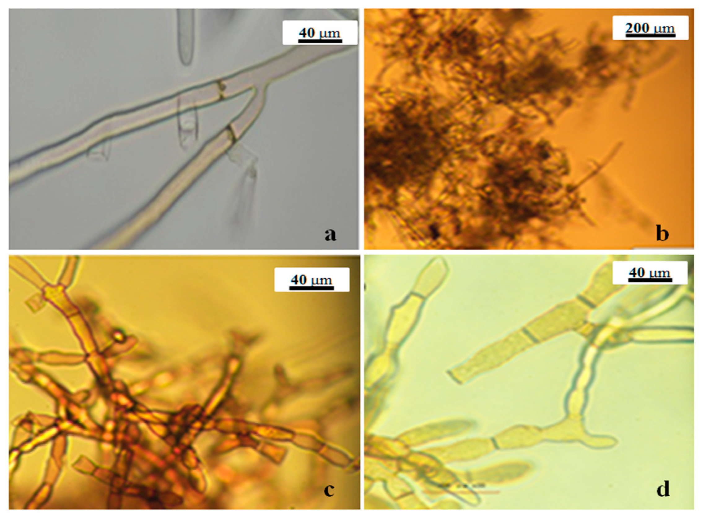 Pathogens 11 00627 g007