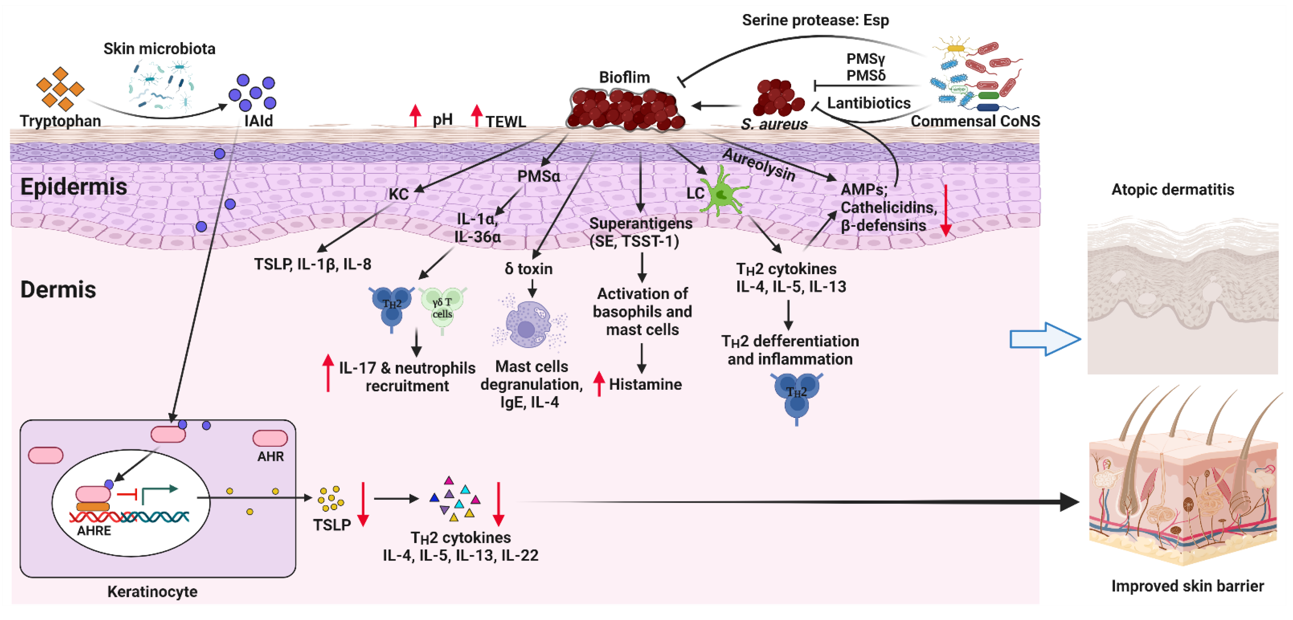 Pathogenesis and Management of Atopic