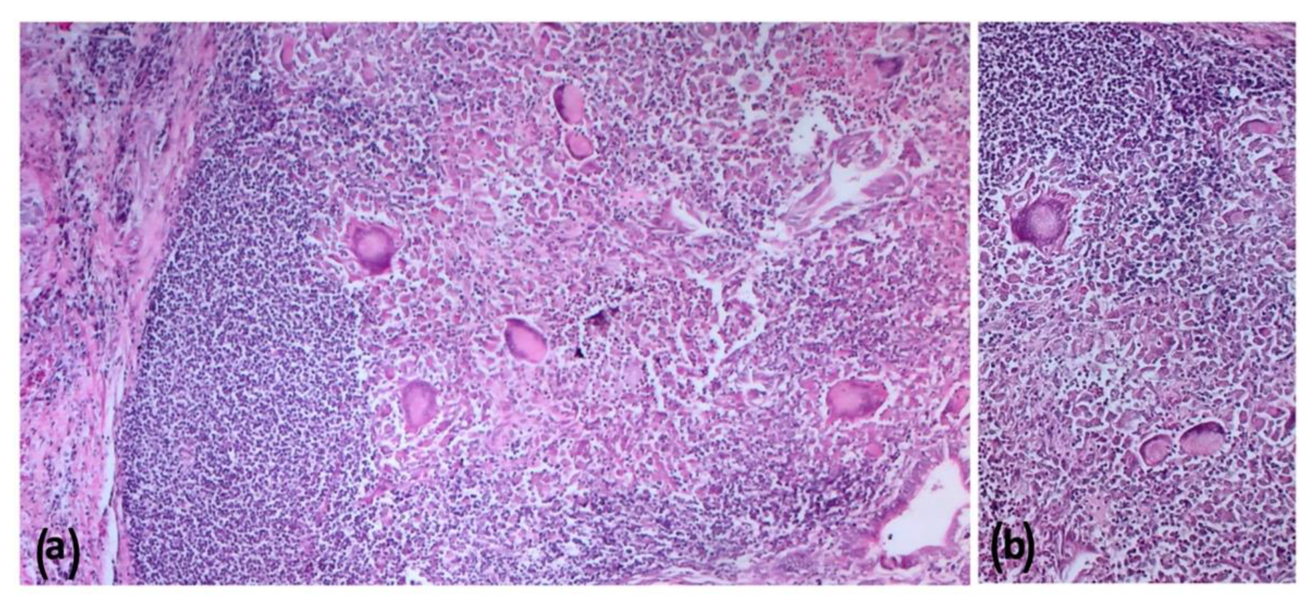 Pathogens 11 00649 g009