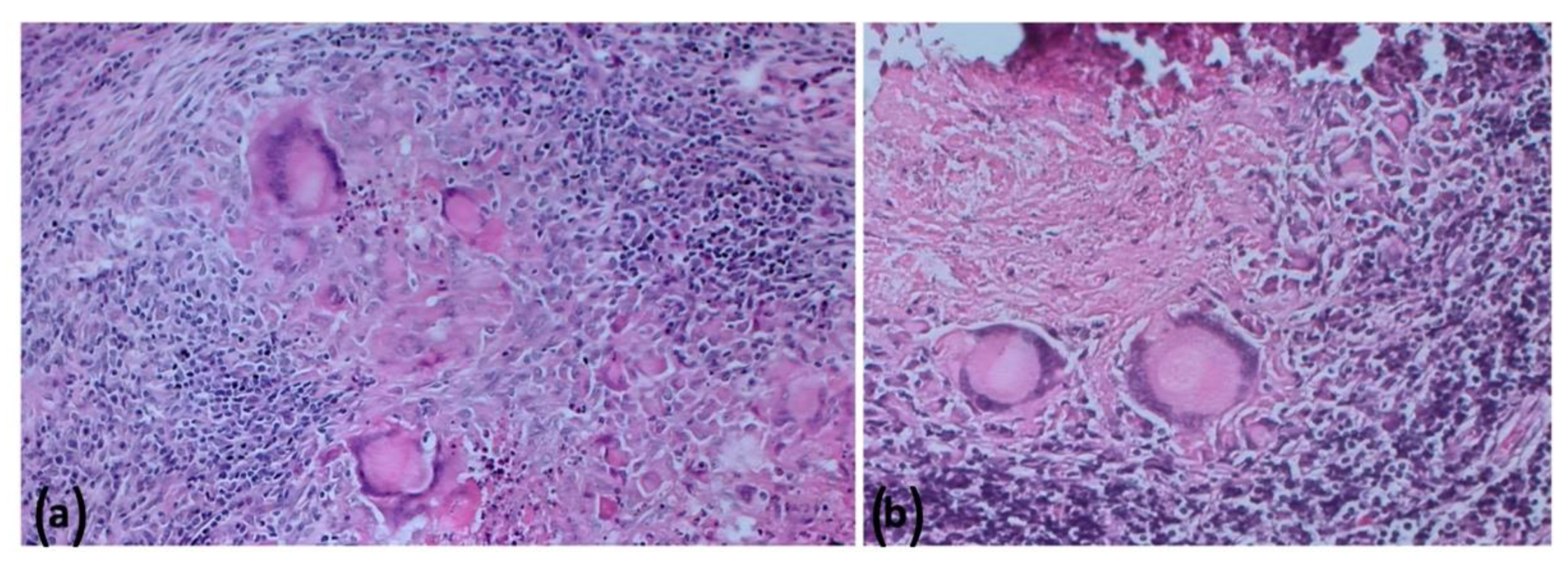 Pathogens 11 00649 g010