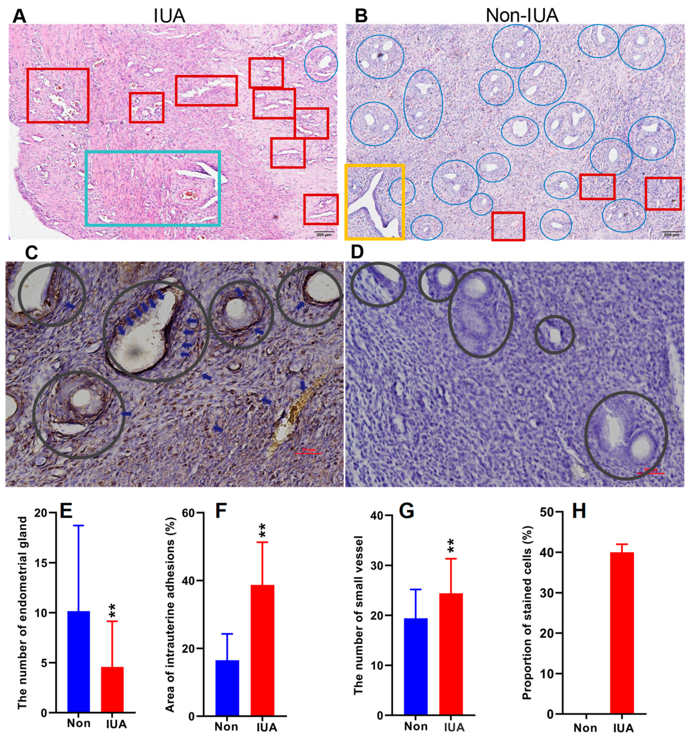 Pathogens | Free Full-Text | Association of Intrauterine Microbes