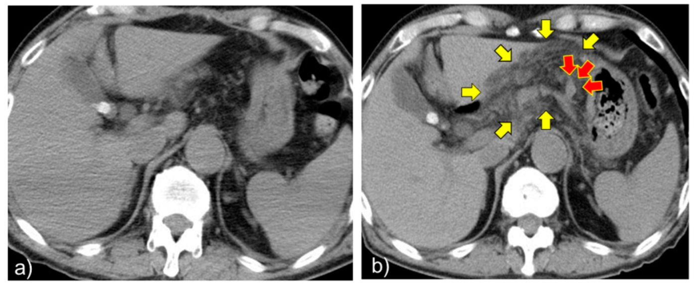 Pathogens 11 00815 g004