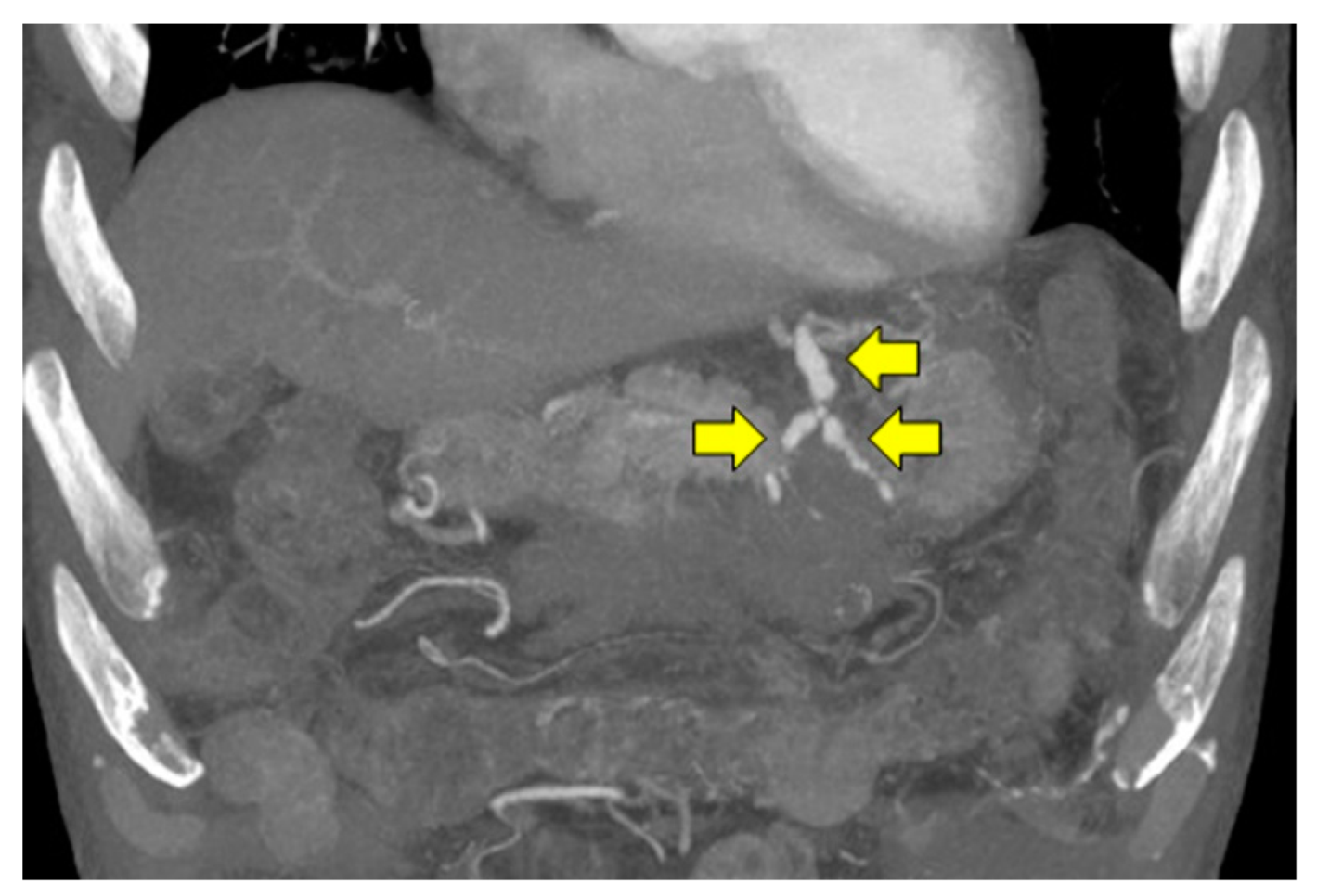 Pathogens 11 00815 g005