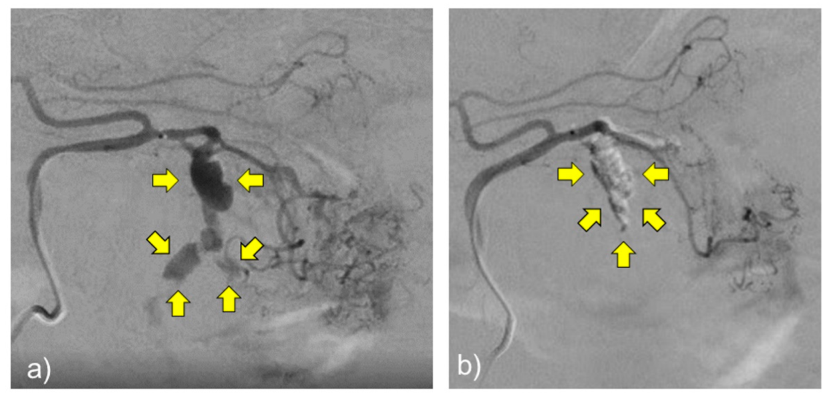 Pathogens 11 00815 g006