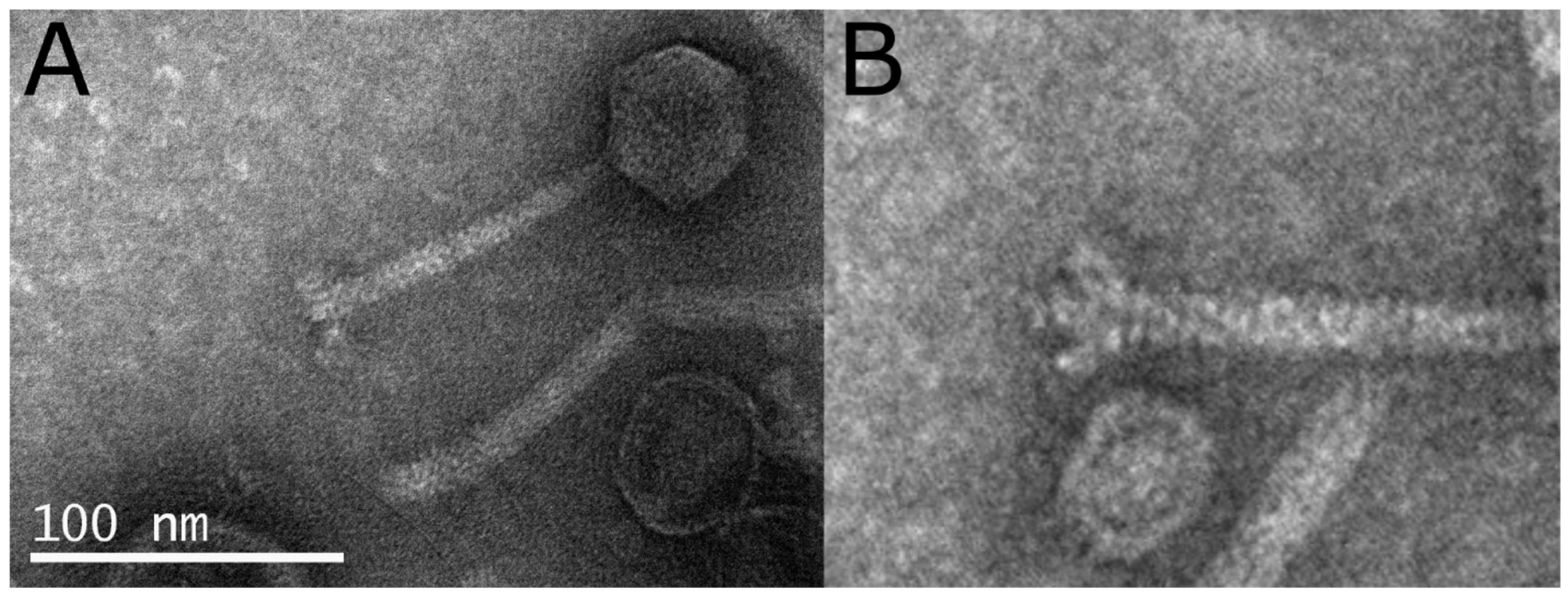 Pathogens 11 00848 g001 550