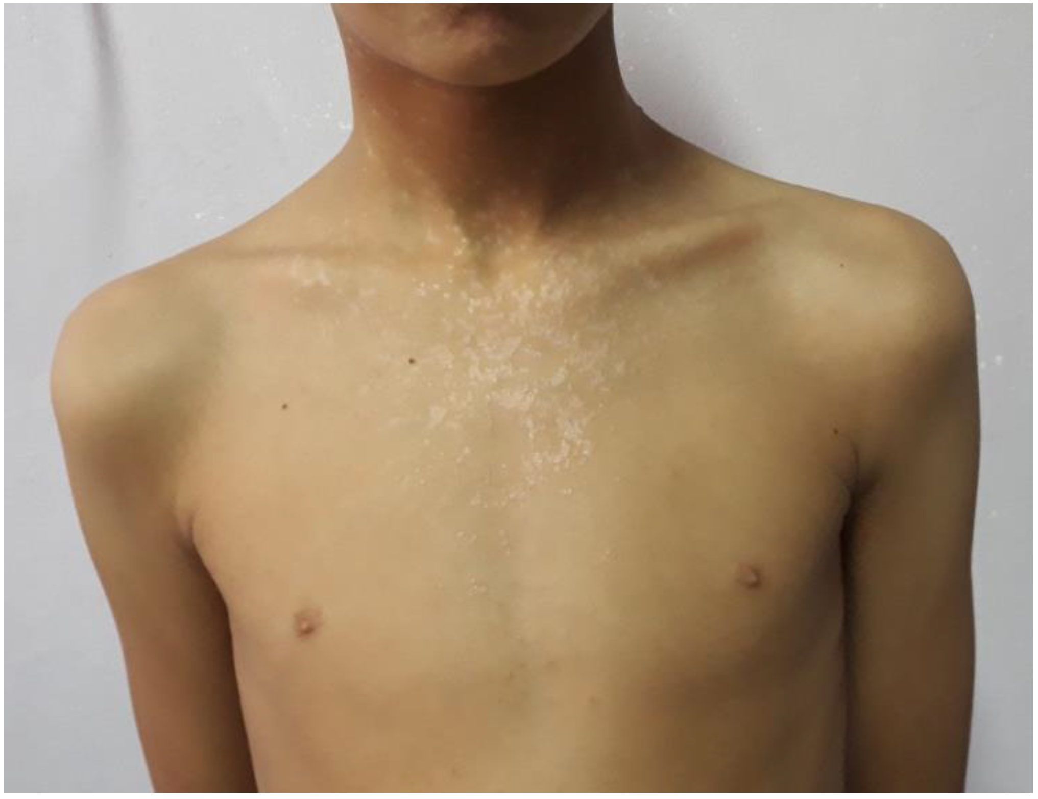 Pathogens 11 00857 g001