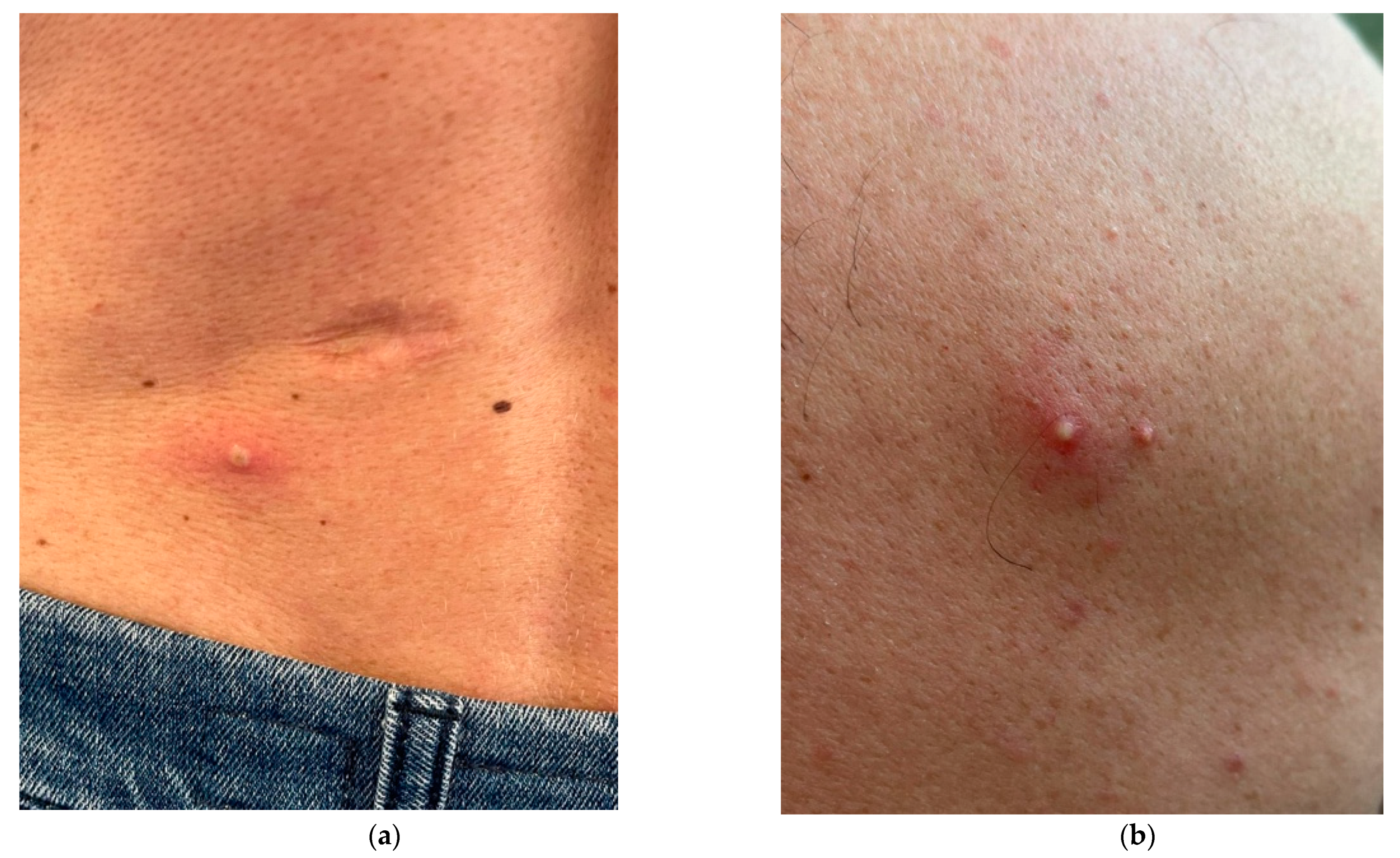 Pathogens 11 00869 g001