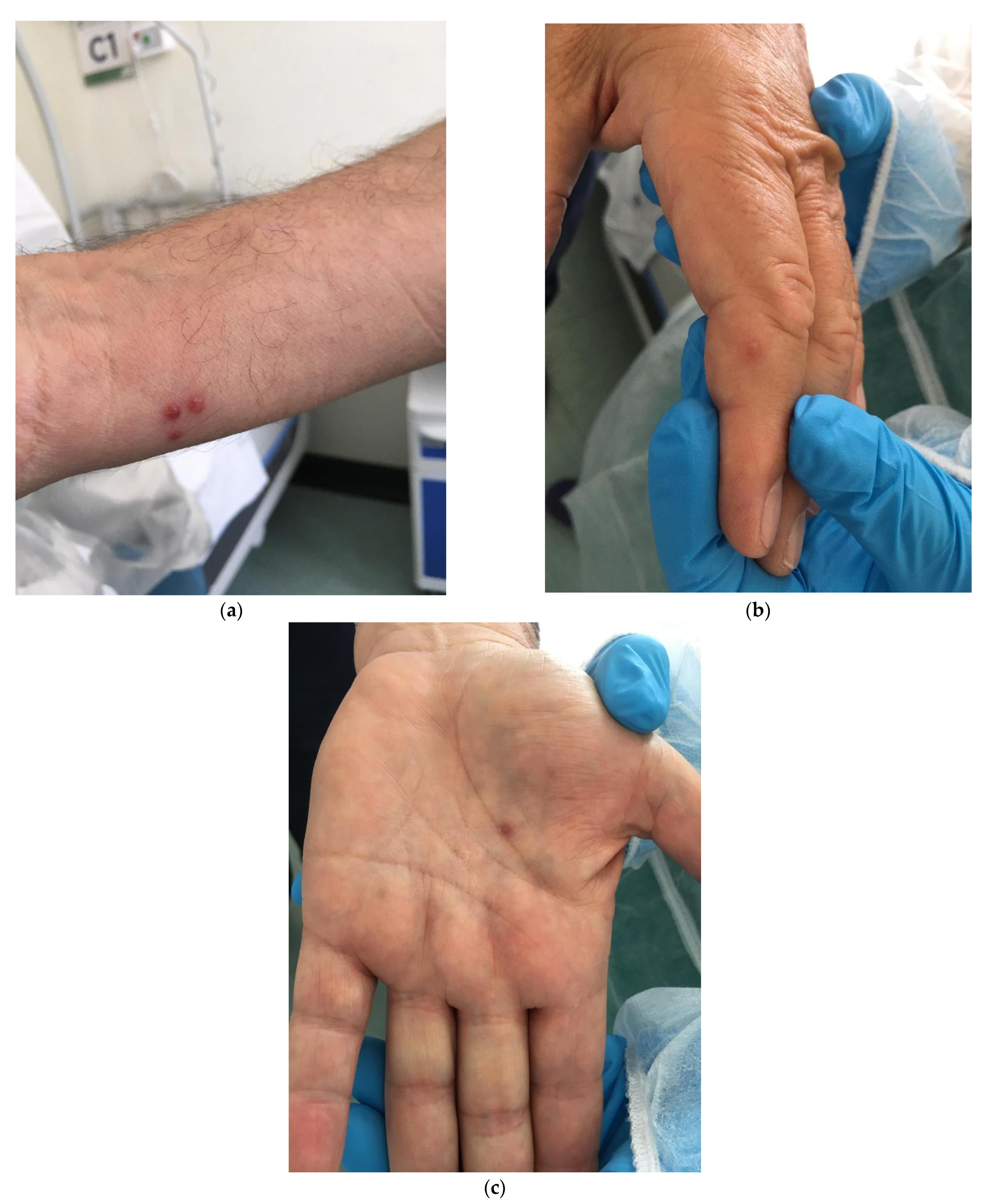 Pathogens 11 00869 g005