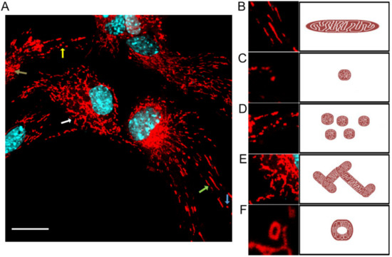 Ischemia-induced cleavage of OPA1 at S1 site aggravates