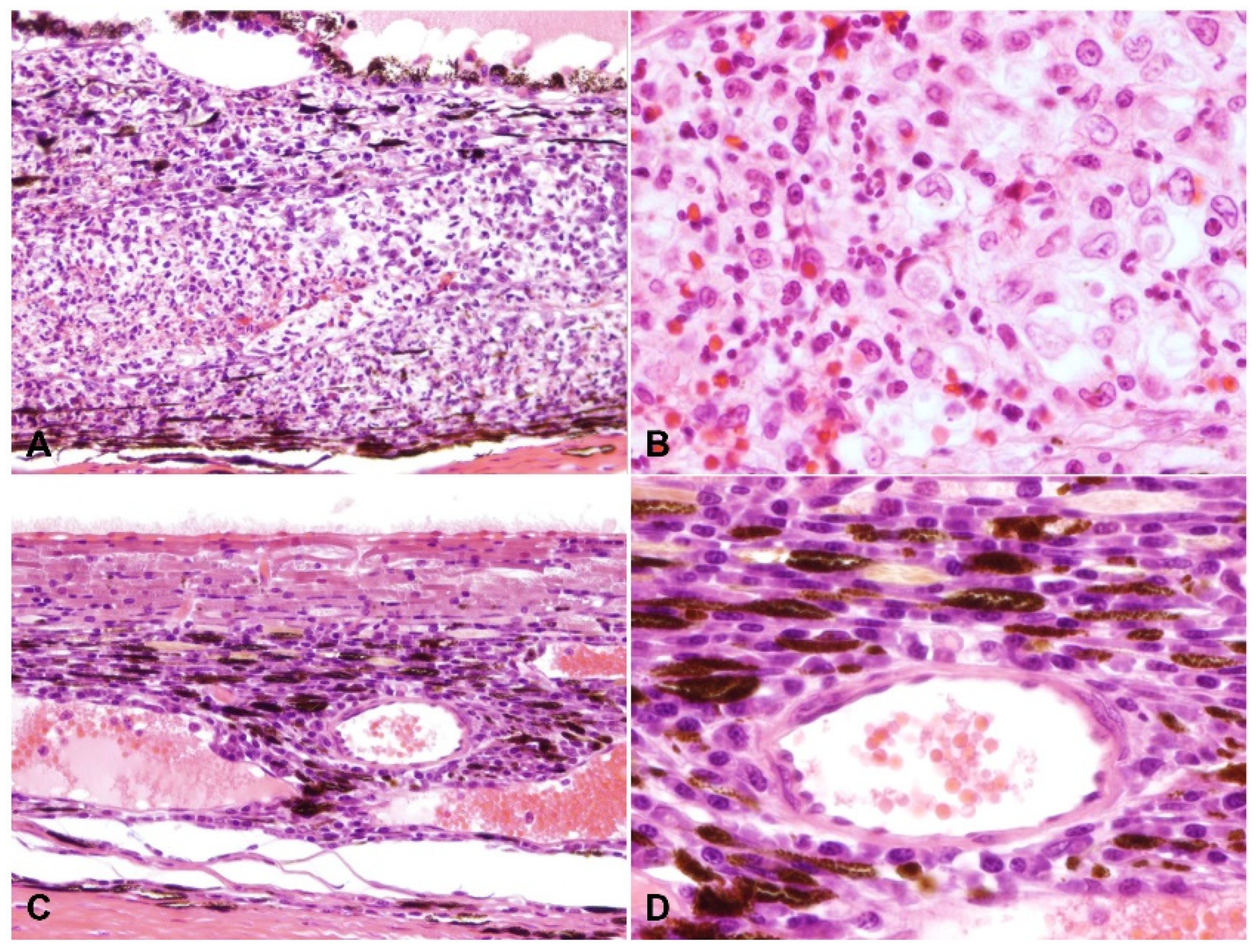 Pathogens 11 00883 g004
