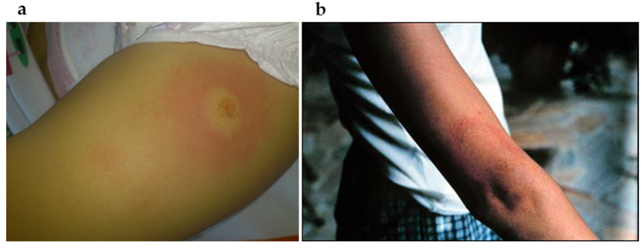 Pathogens 11 00889 g012 Pathogens 11 00889 g012