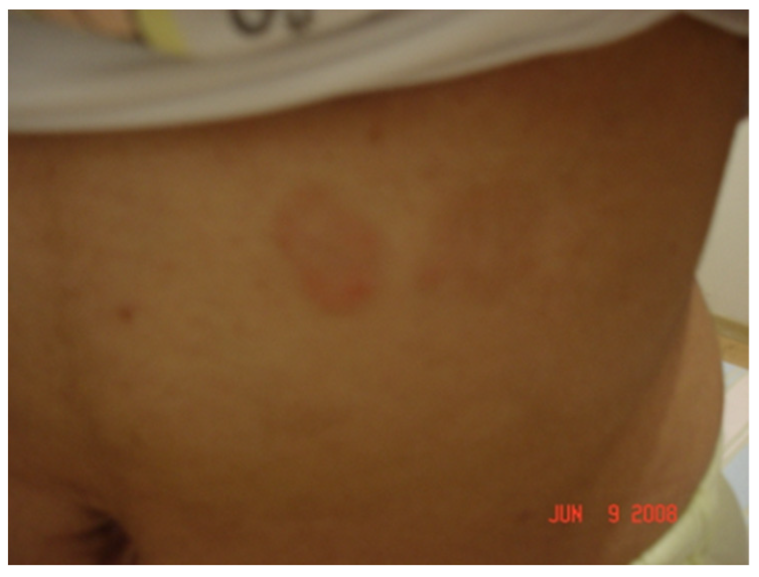 Pathogens 11 00889 g017 Pathogens 11 00889 g017