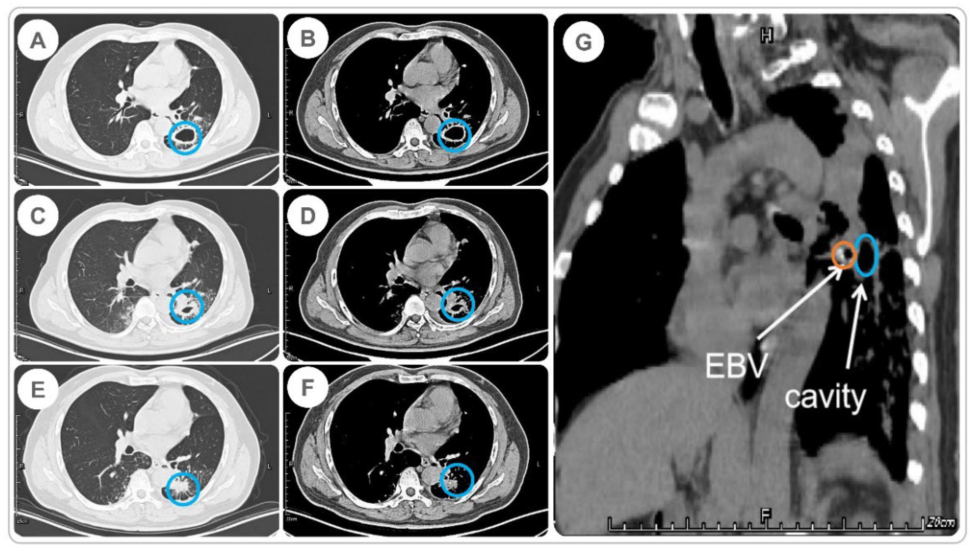 Pathogens 11 00899 g003