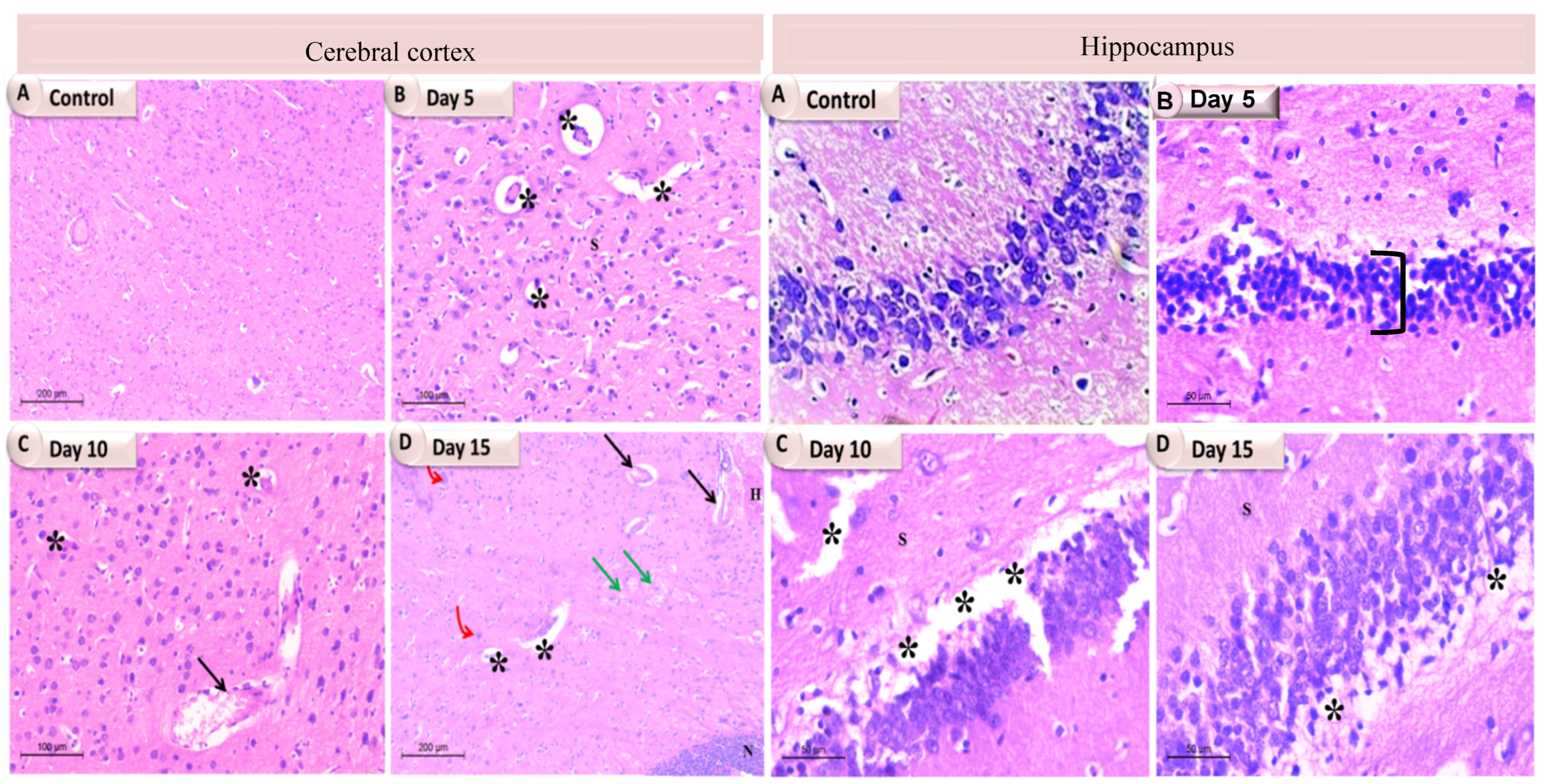 Pathogens 11 00933 g005