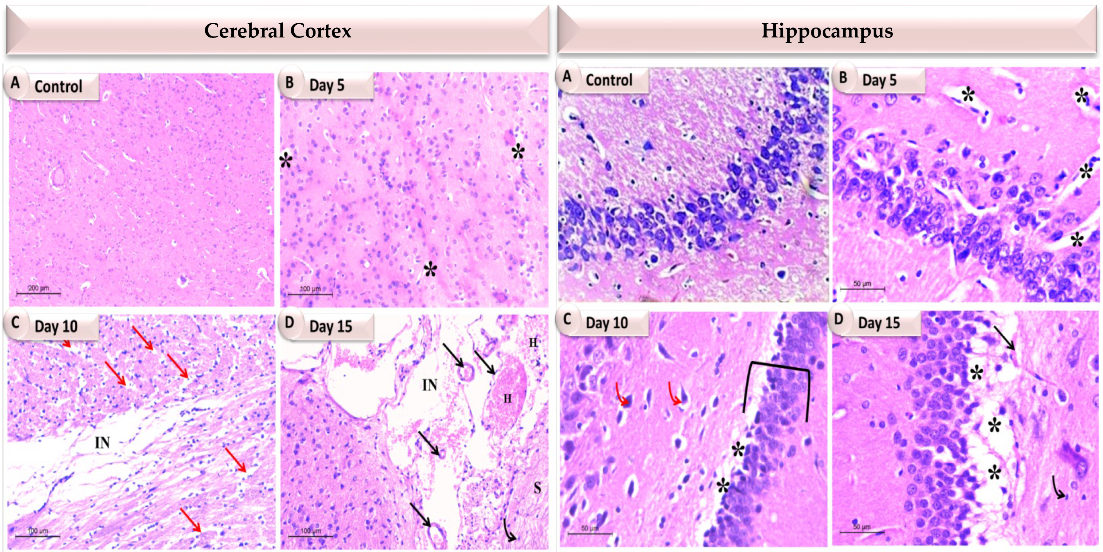 Pathogens 11 00933 g006