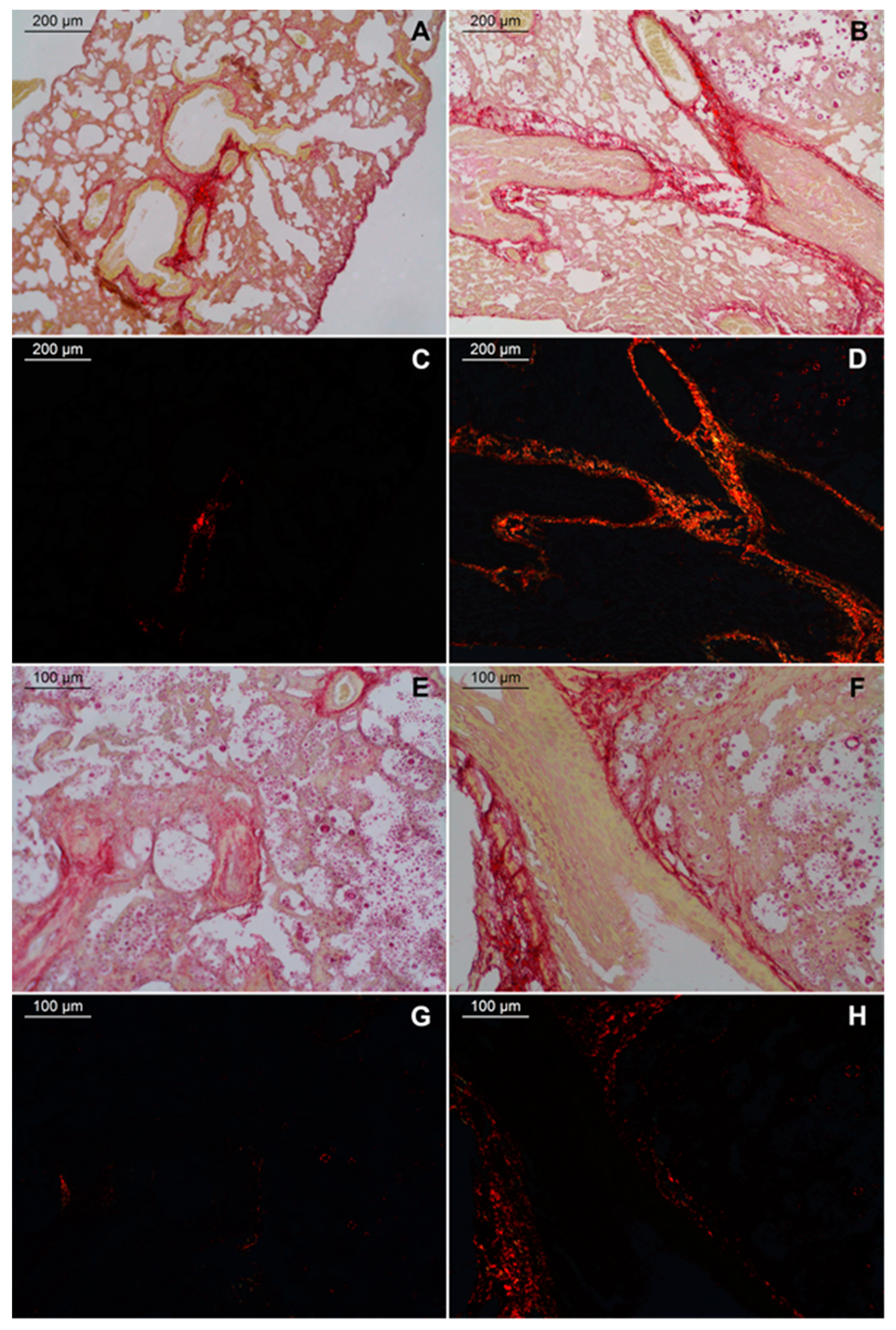 Pathogens 11 00987 g004 550