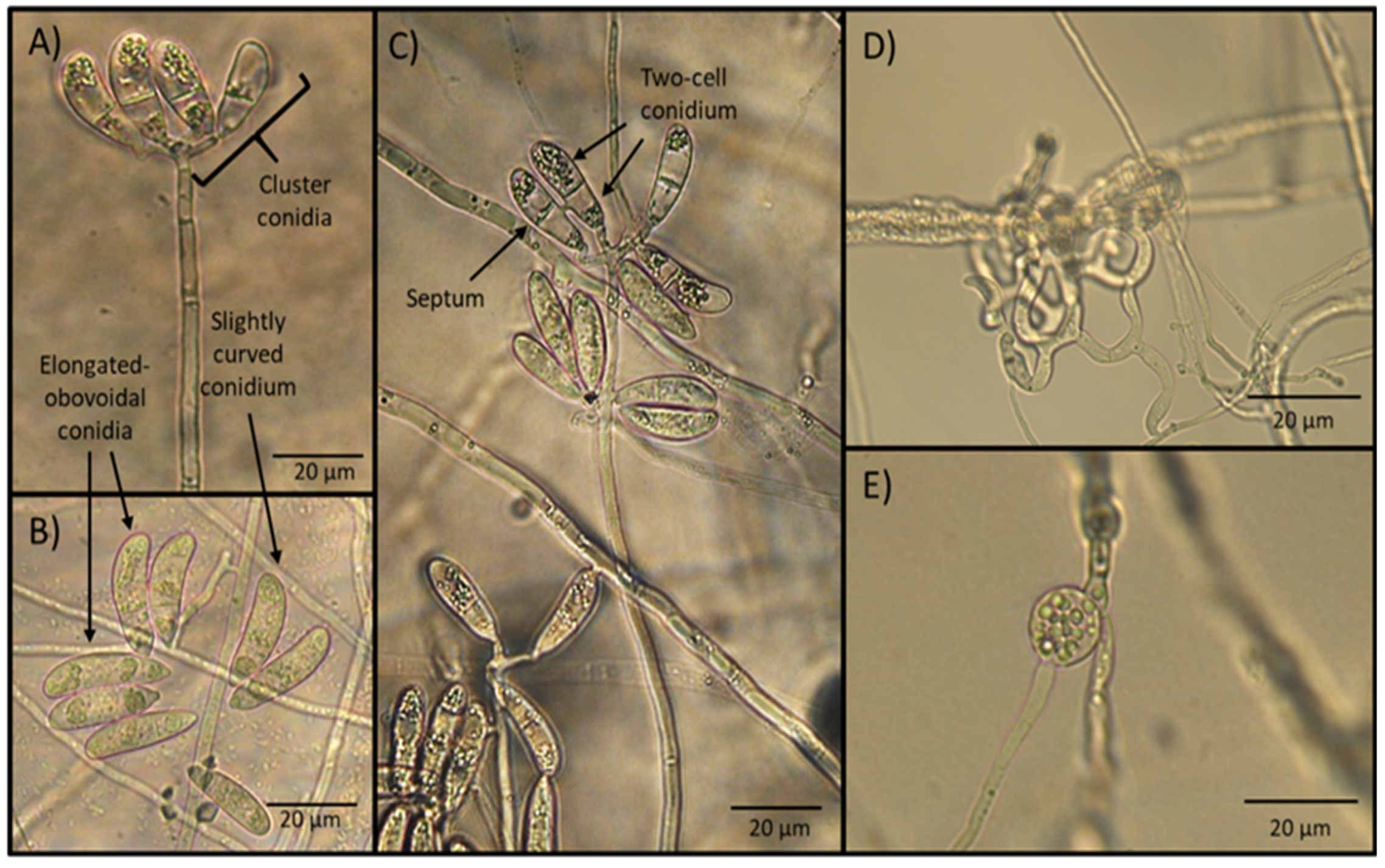 Pathogens 11 01068 g001