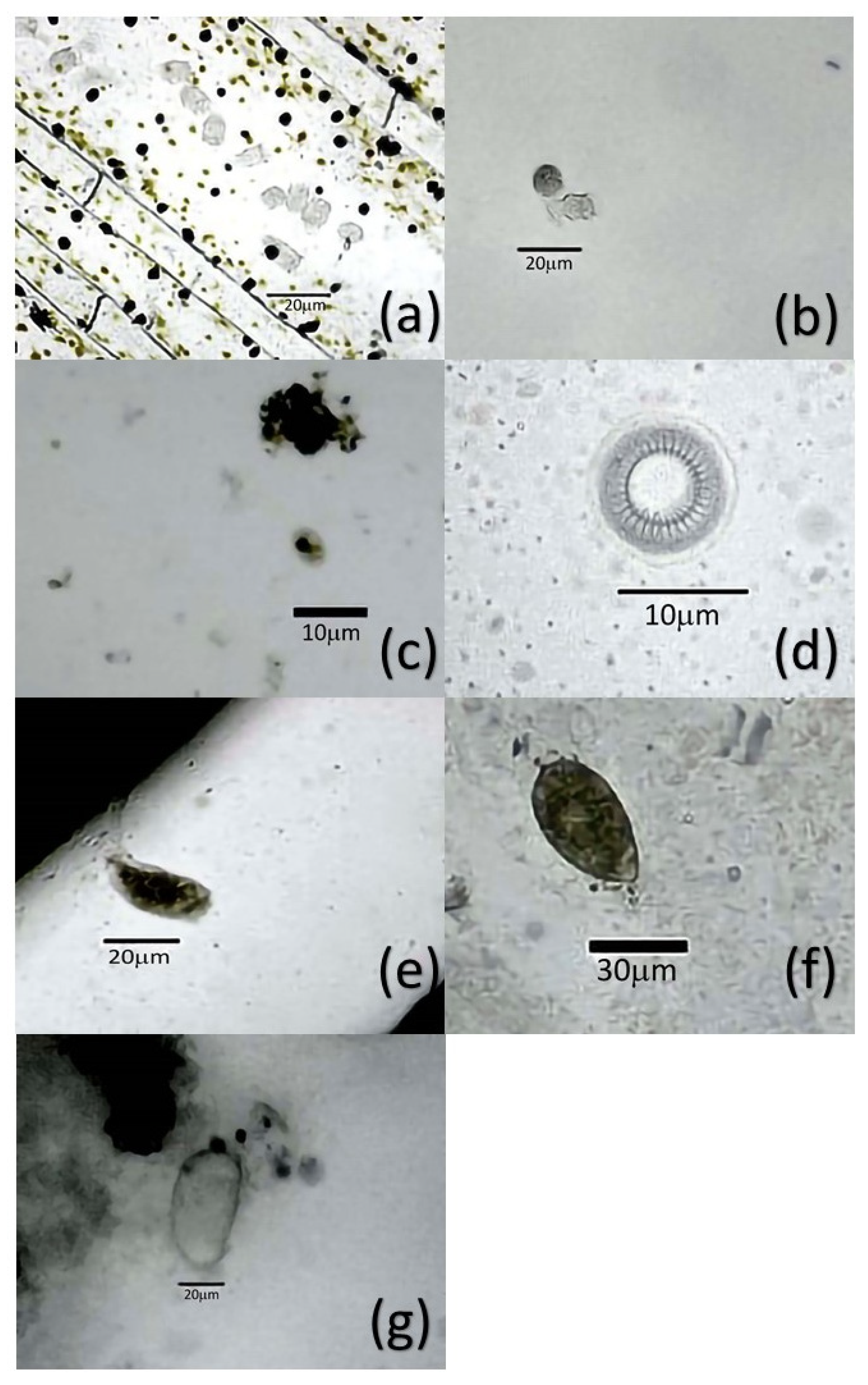 ☆The Ecology of Aquatic Hyphomycetes [水生不完全糸状菌の