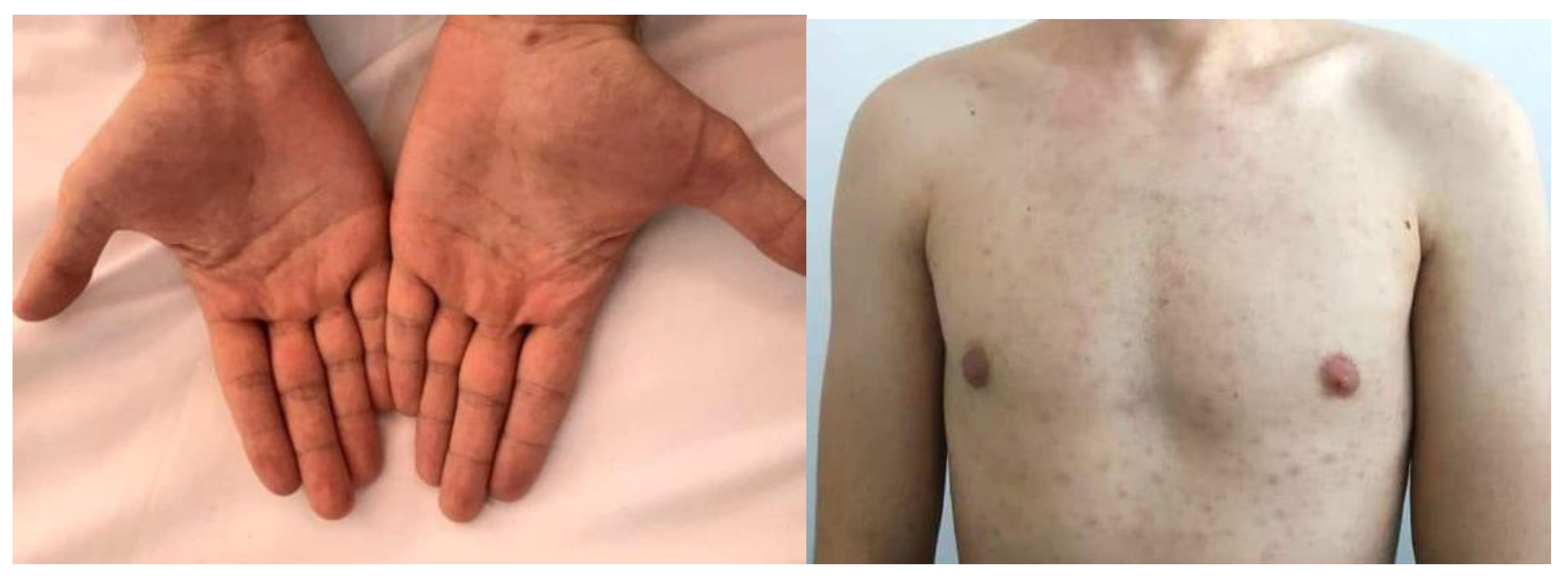 Pathogens 11 01151 g002