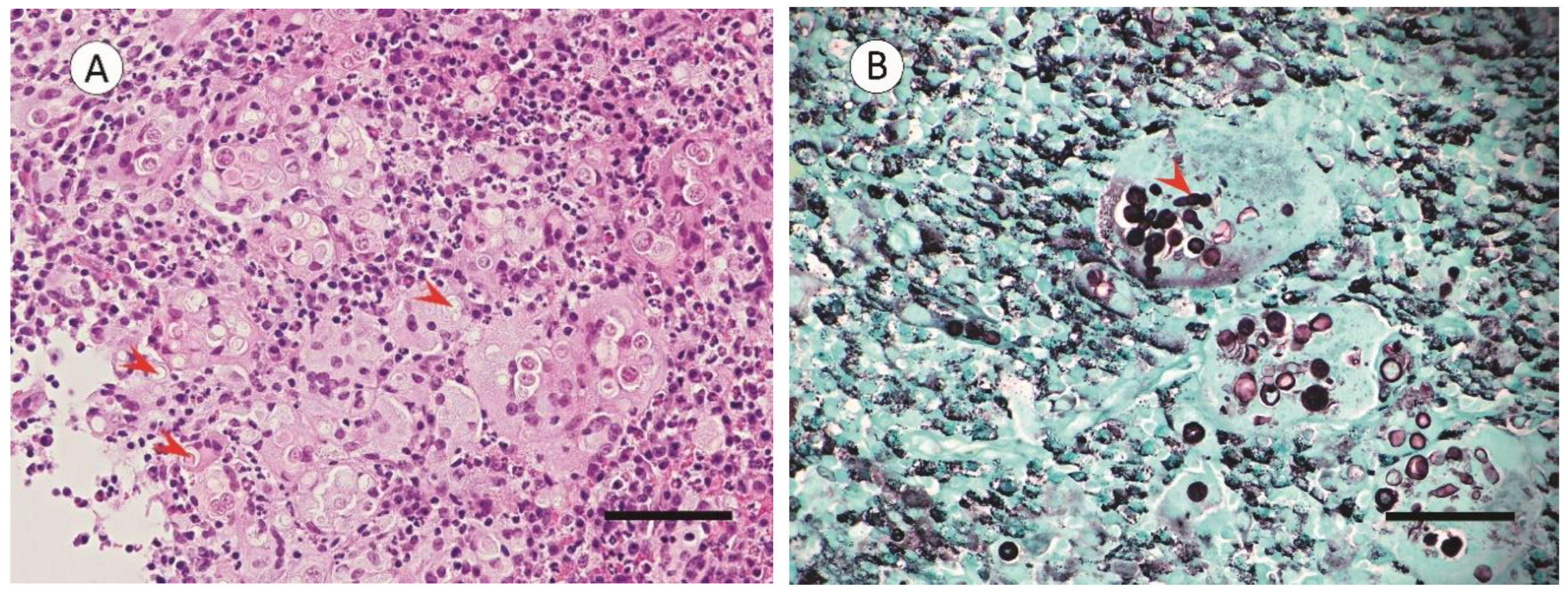 Pathogens 11 01166 g002