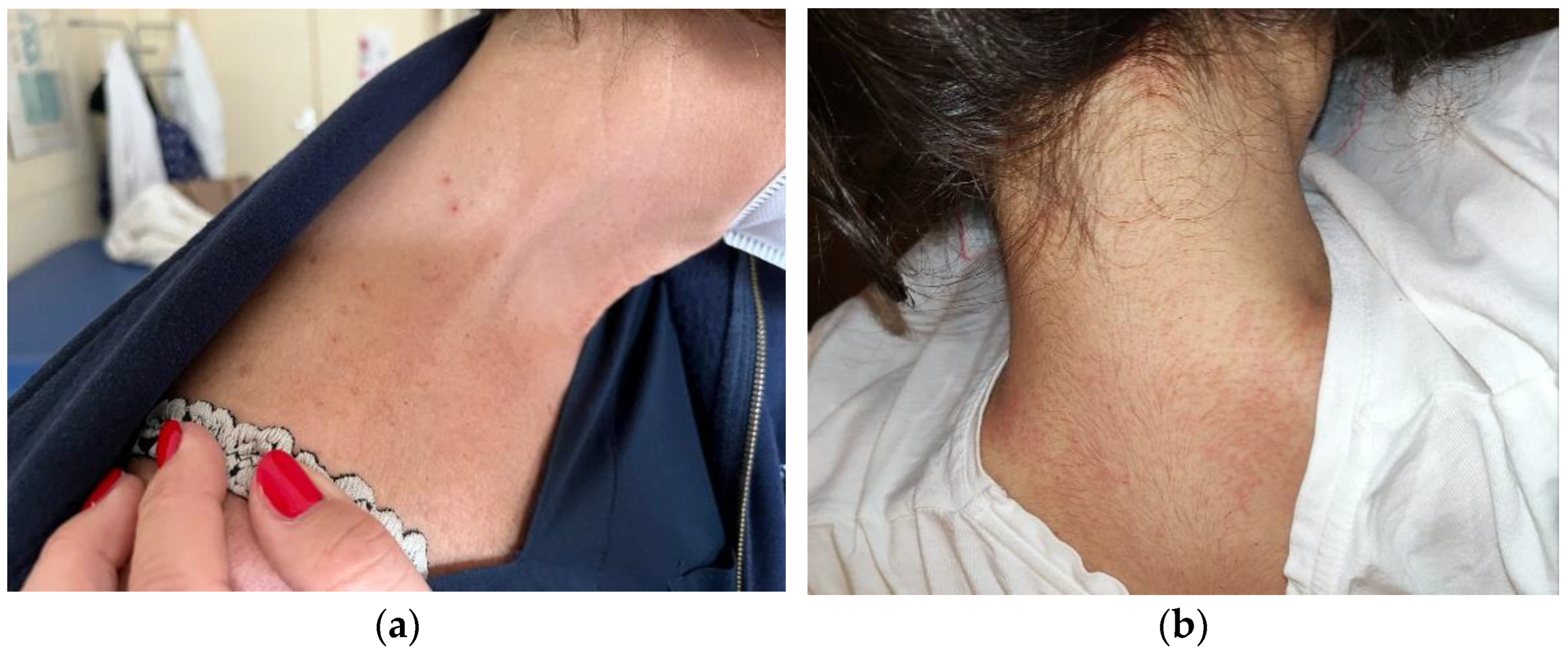 Pathogens 11 01396 g001