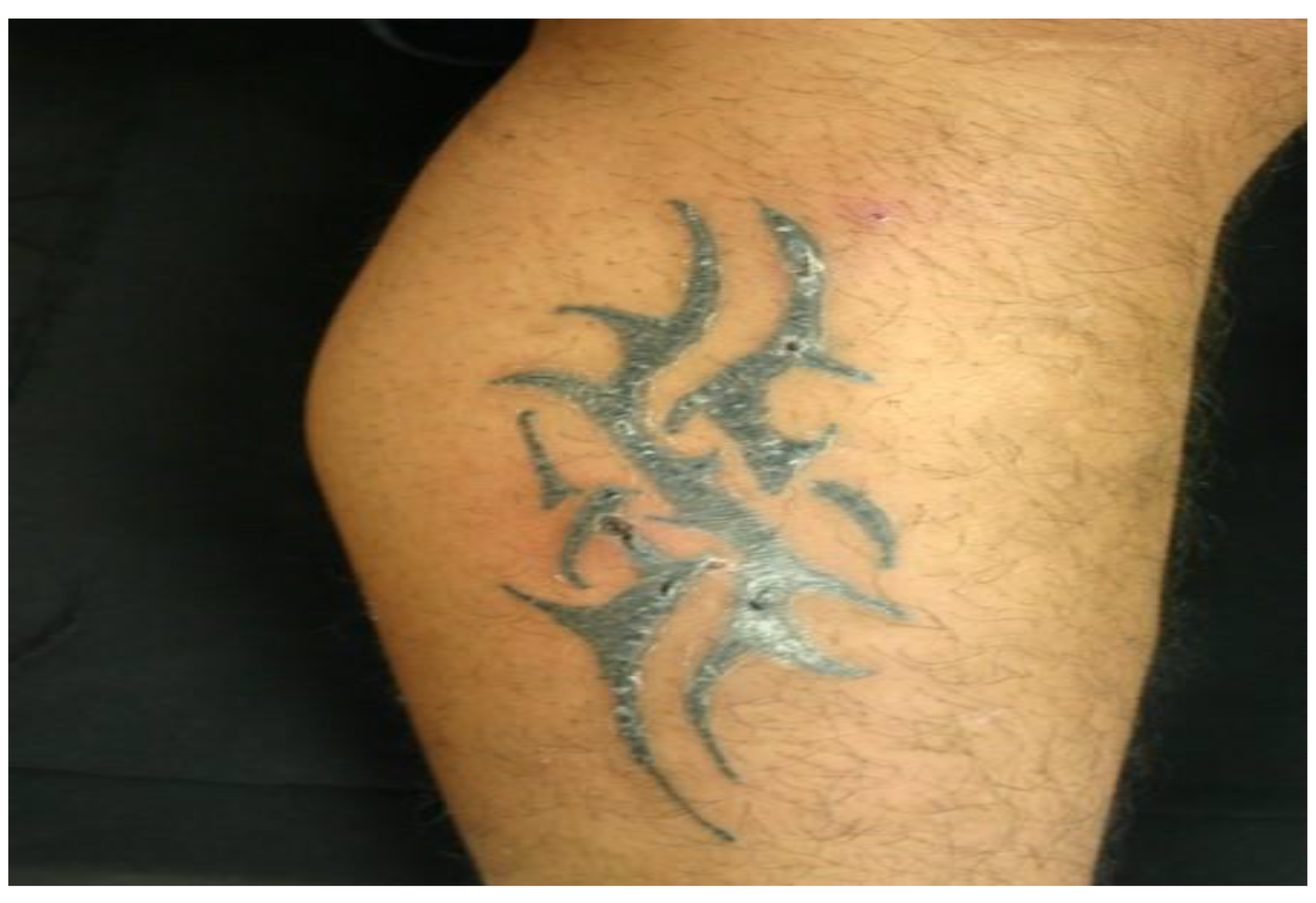 Pathogens 11 01399 g003 Pathogens 11 01399 g003