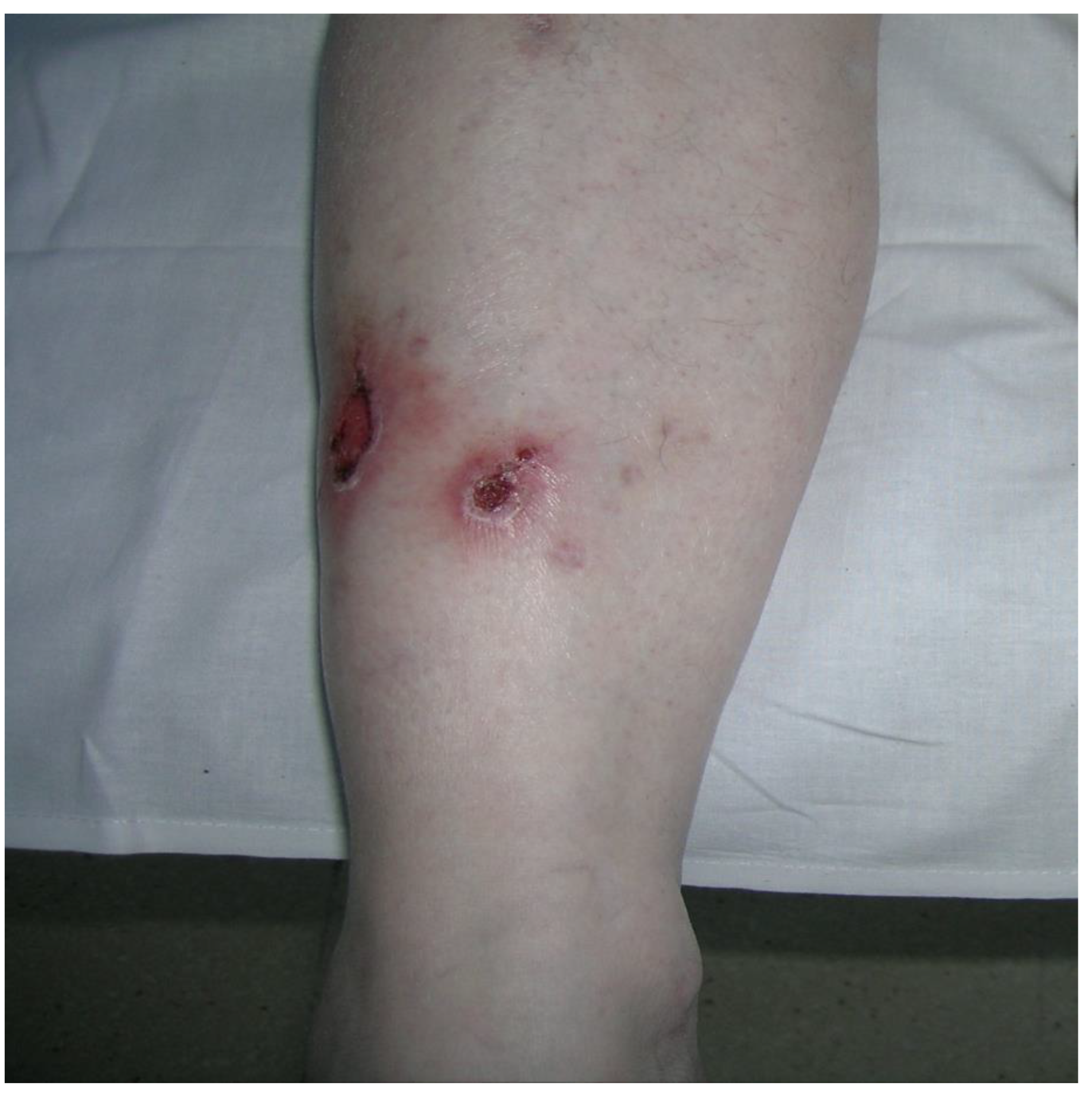 Pathogens 11 01399 g004 Pathogens 11 01399 g004