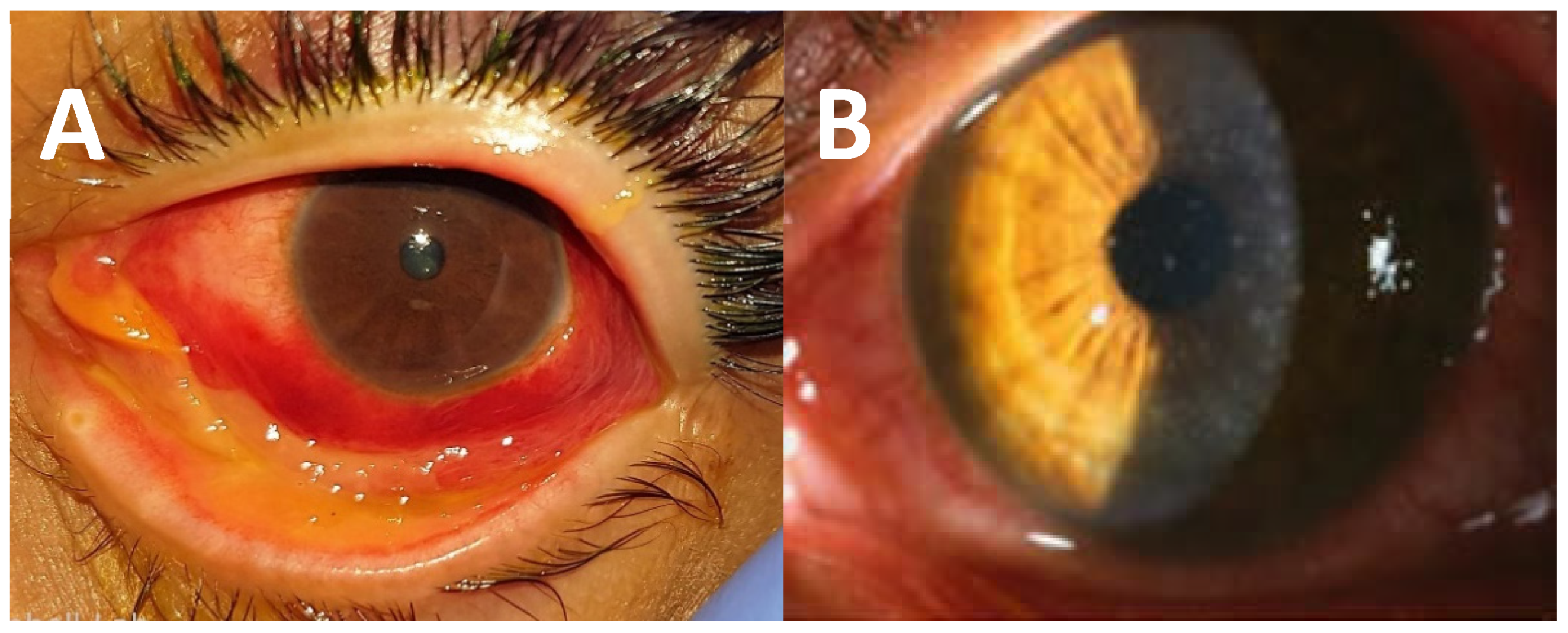 Pathogens 11 01485 g001