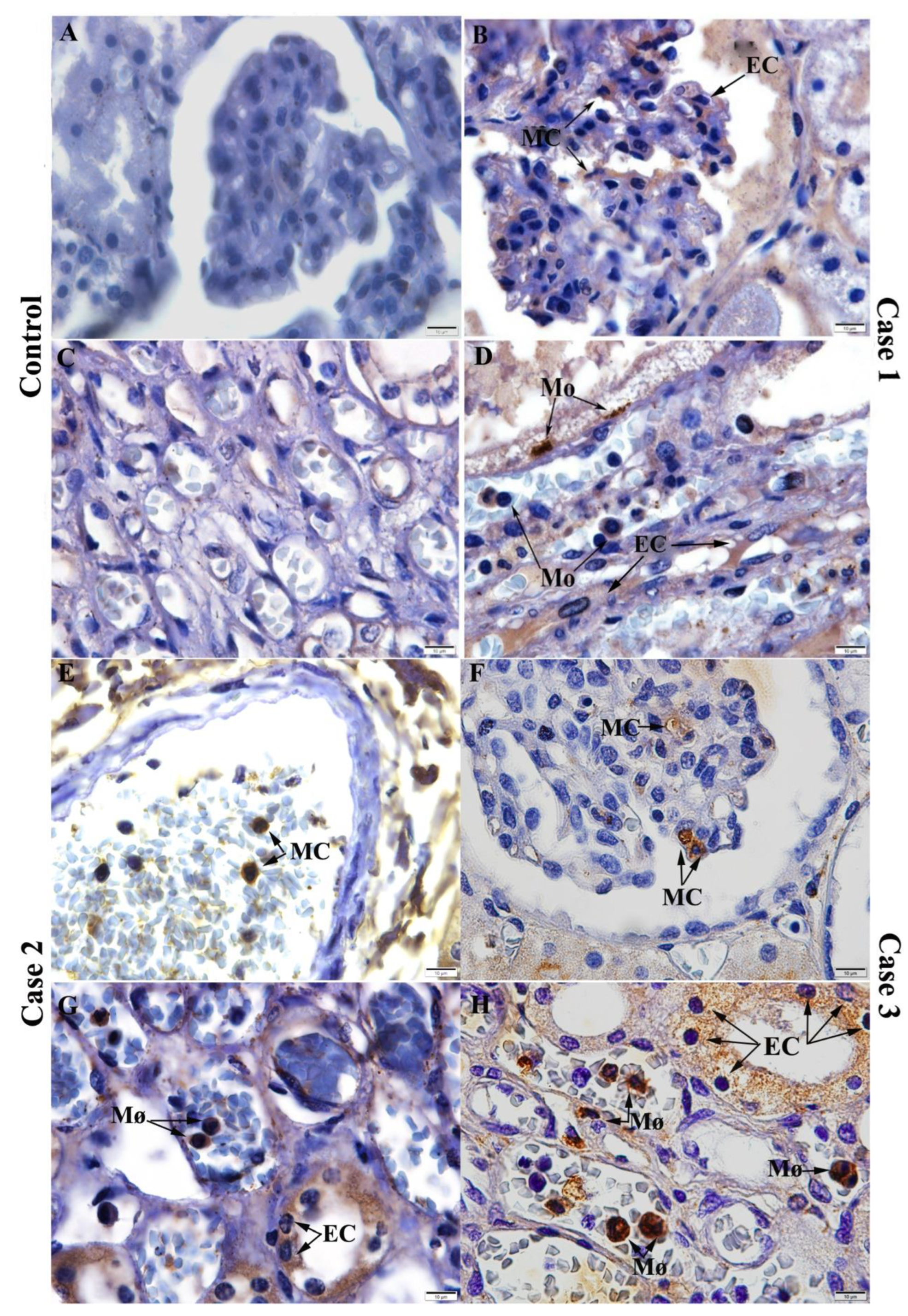 Pathogens 11 01543 g004