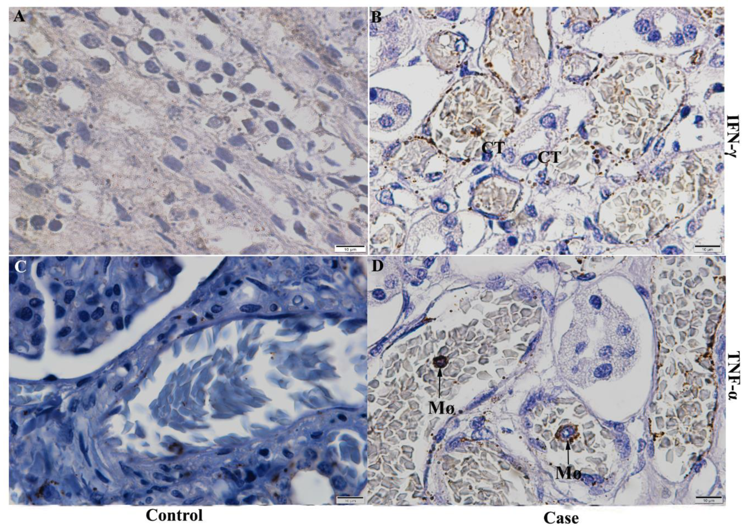 Pathogens 11 01543 g006