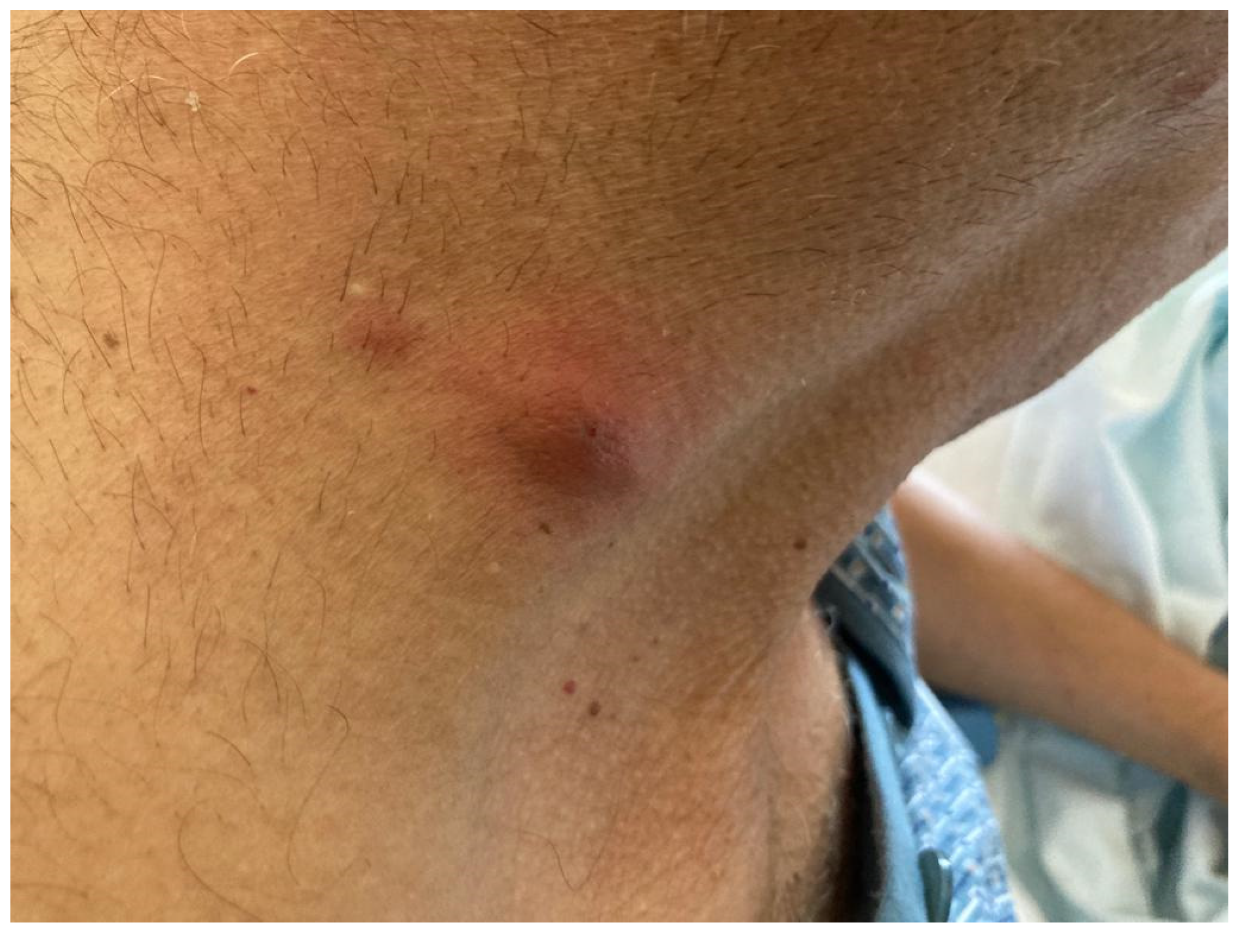 Pathogens 12 00068 g002 Pathogens 12 00068 g002