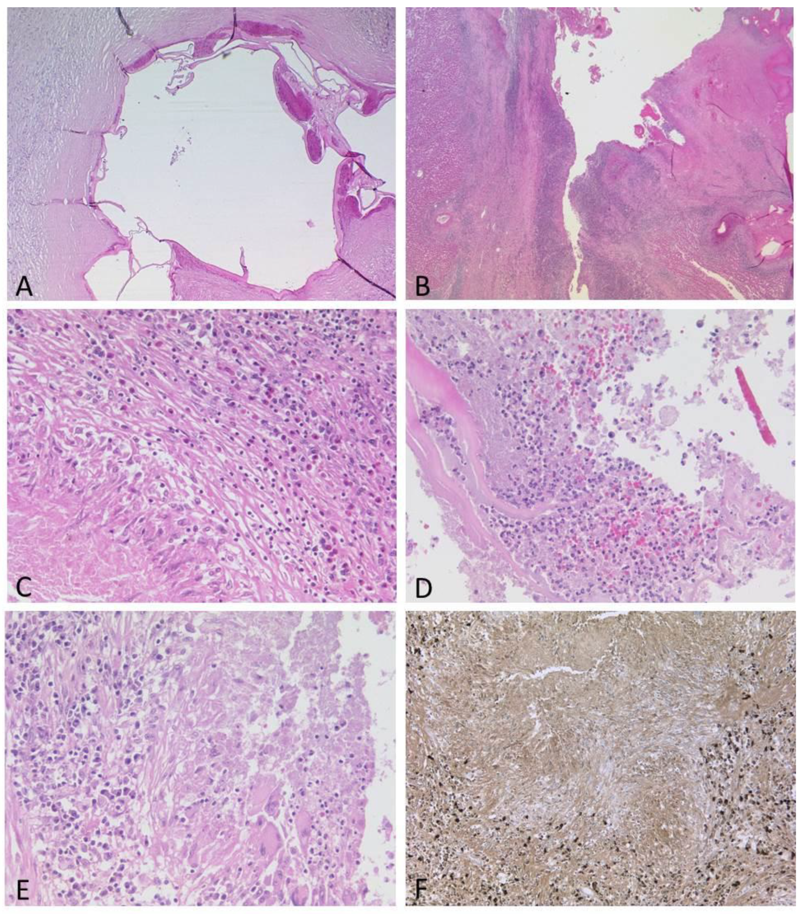 Pathogens 12 00073 g004 Pathogens 12 00073 g004