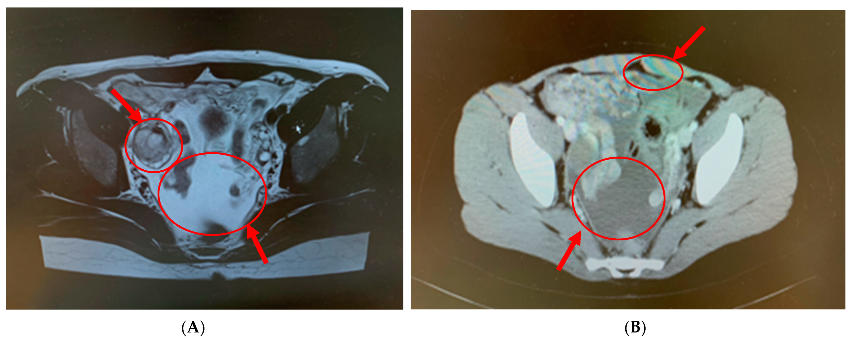 Pathogens 12 00094 g001 Pathogens 12 00094 g001