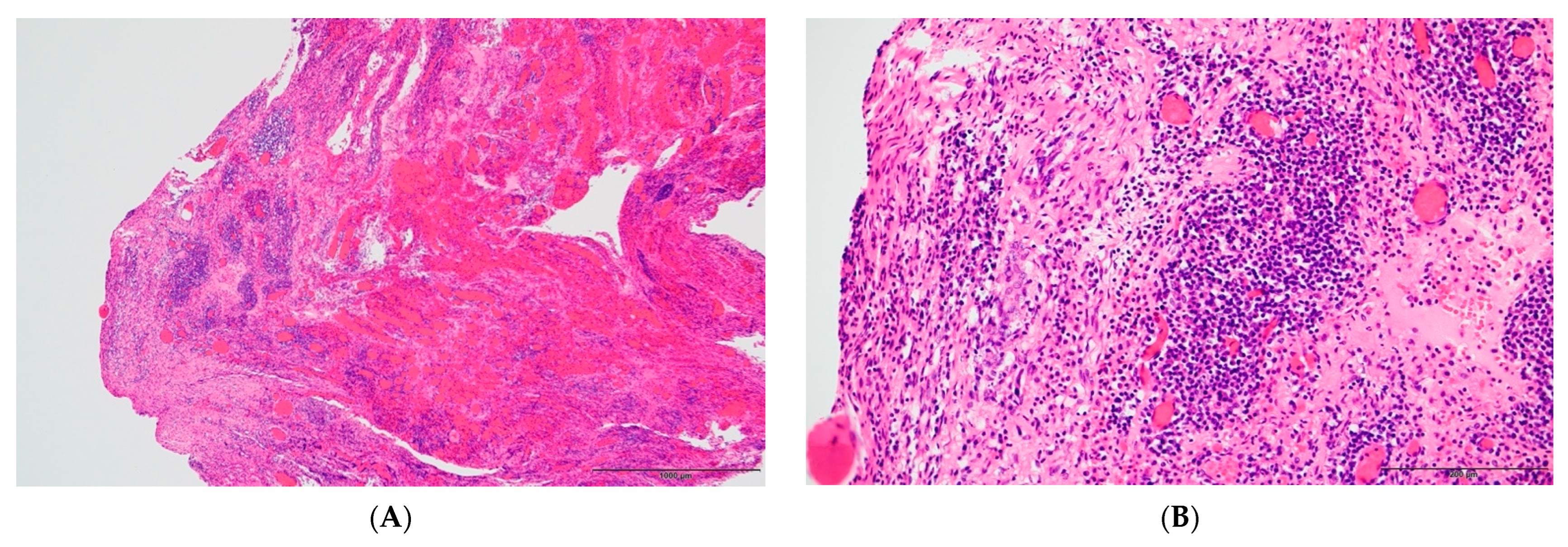 Pathogens 12 00094 g005 Pathogens 12 00094 g005
