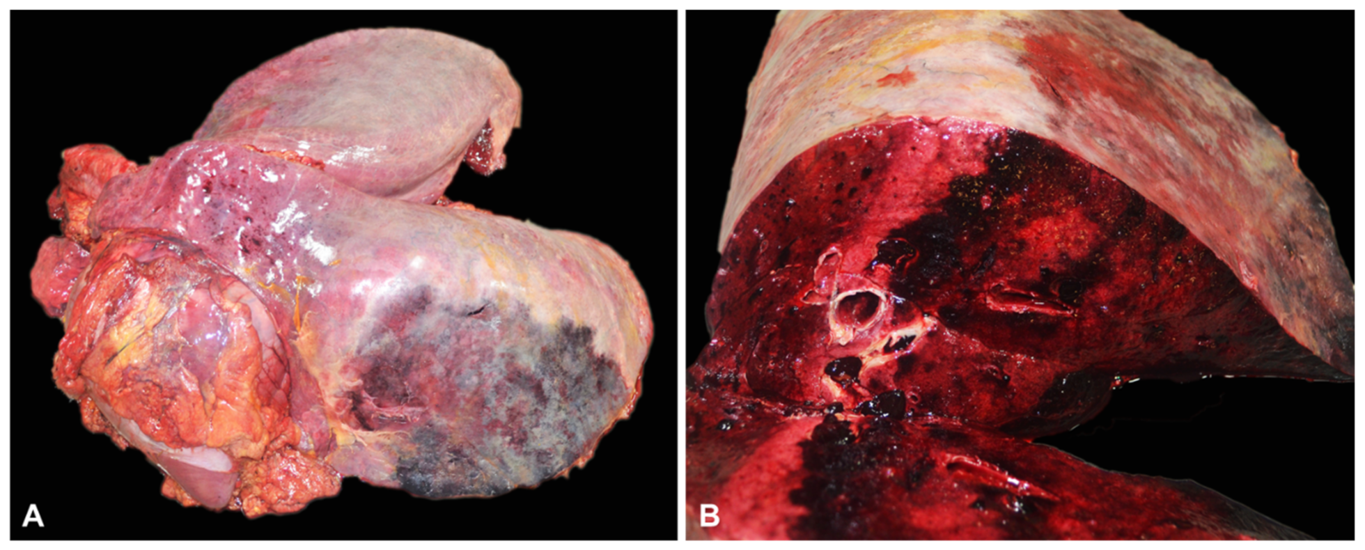 Pathogens 12 00224 g001 Pathogens 12 00224 g001