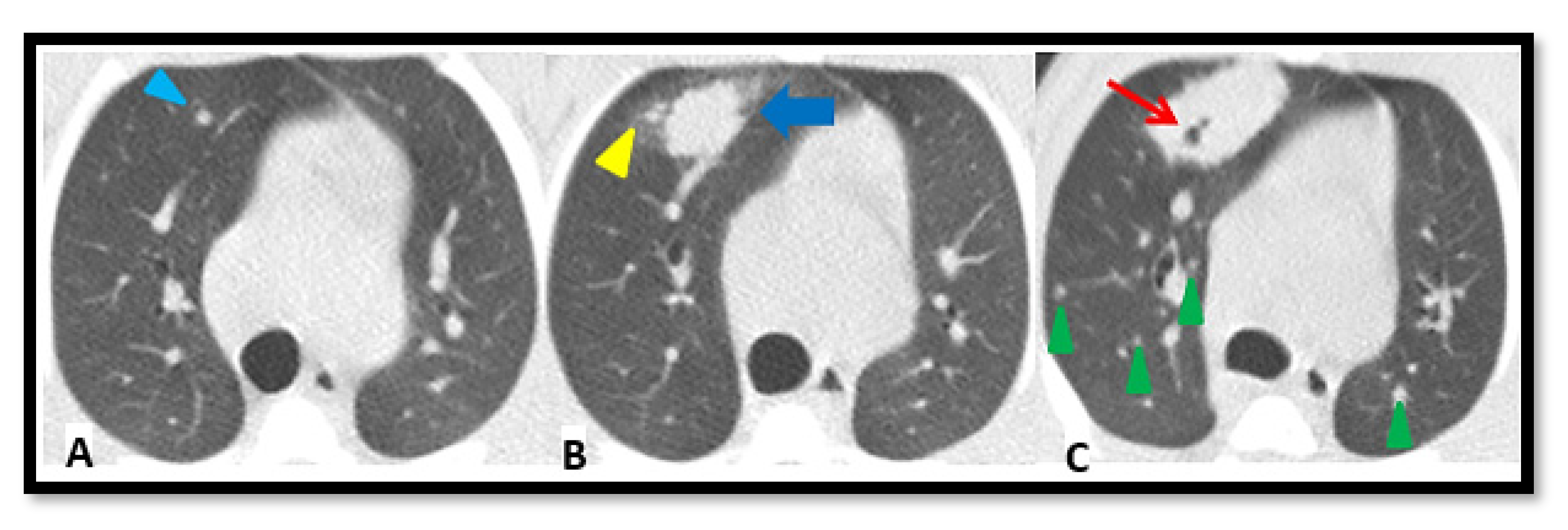 Pathogens 12 00236 g005