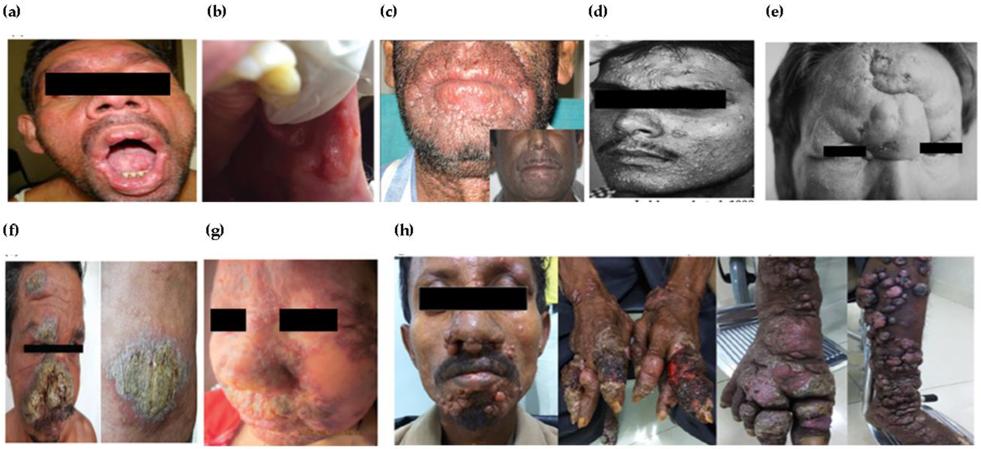 Pathogens 12 00297 g002 Pathogens 12 00297 g002