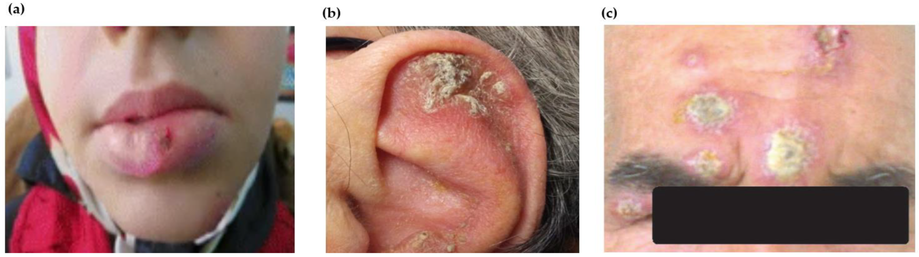 Pathogens 12 00297 g003 Pathogens 12 00297 g003