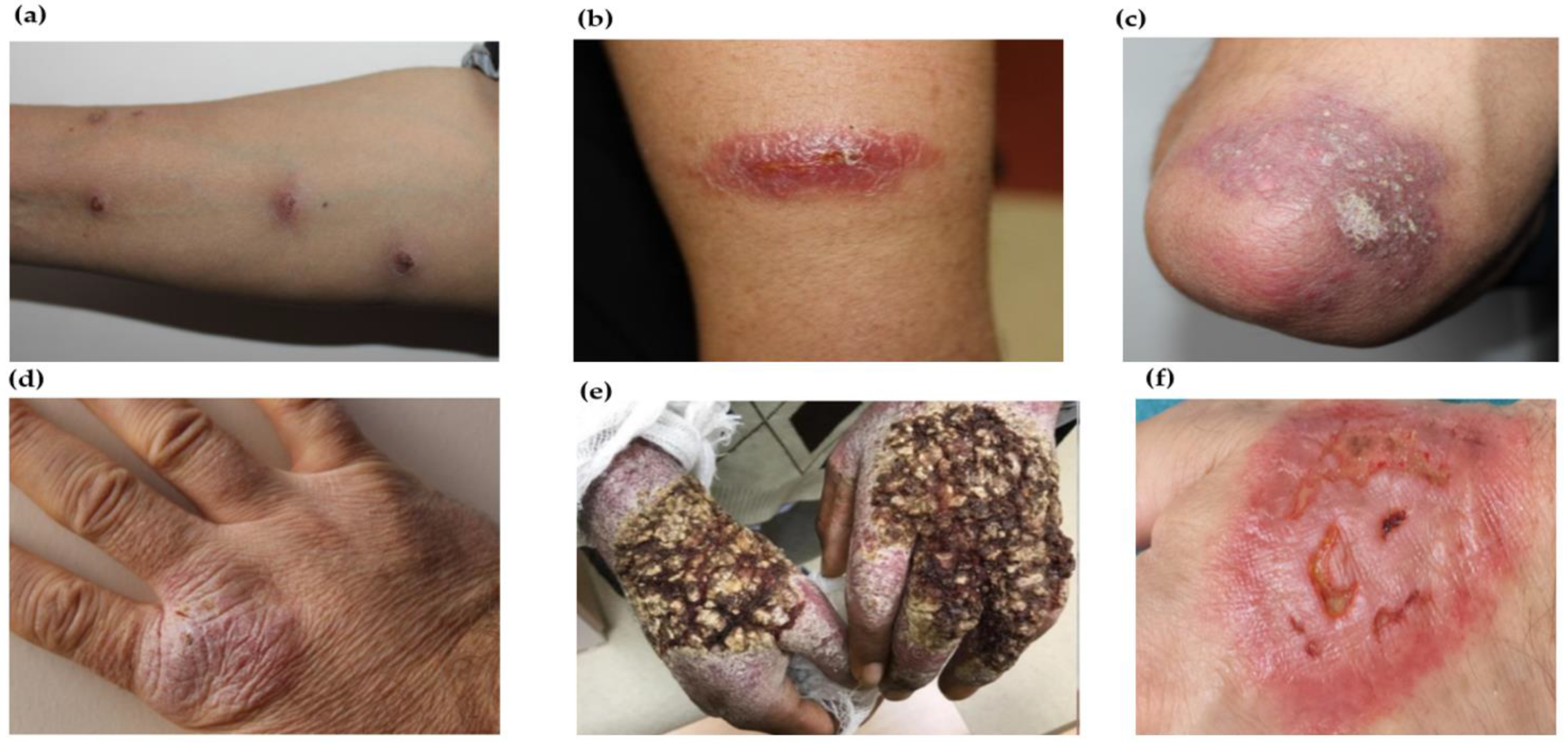 Pathogens 12 00297 g004 Pathogens 12 00297 g004
